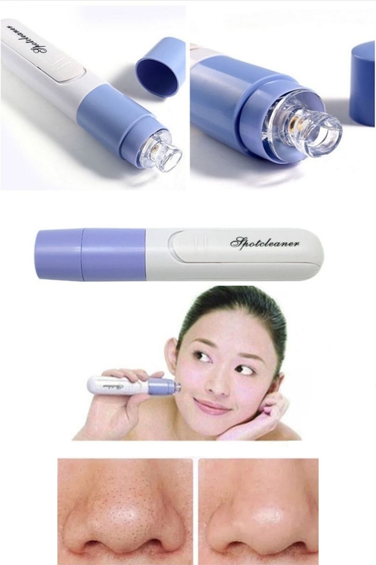 KAİZEN Pore Cleaner Vakumlu Yüz Temizleme Siyah Nokta Temizleme Cihazı 8816581011771