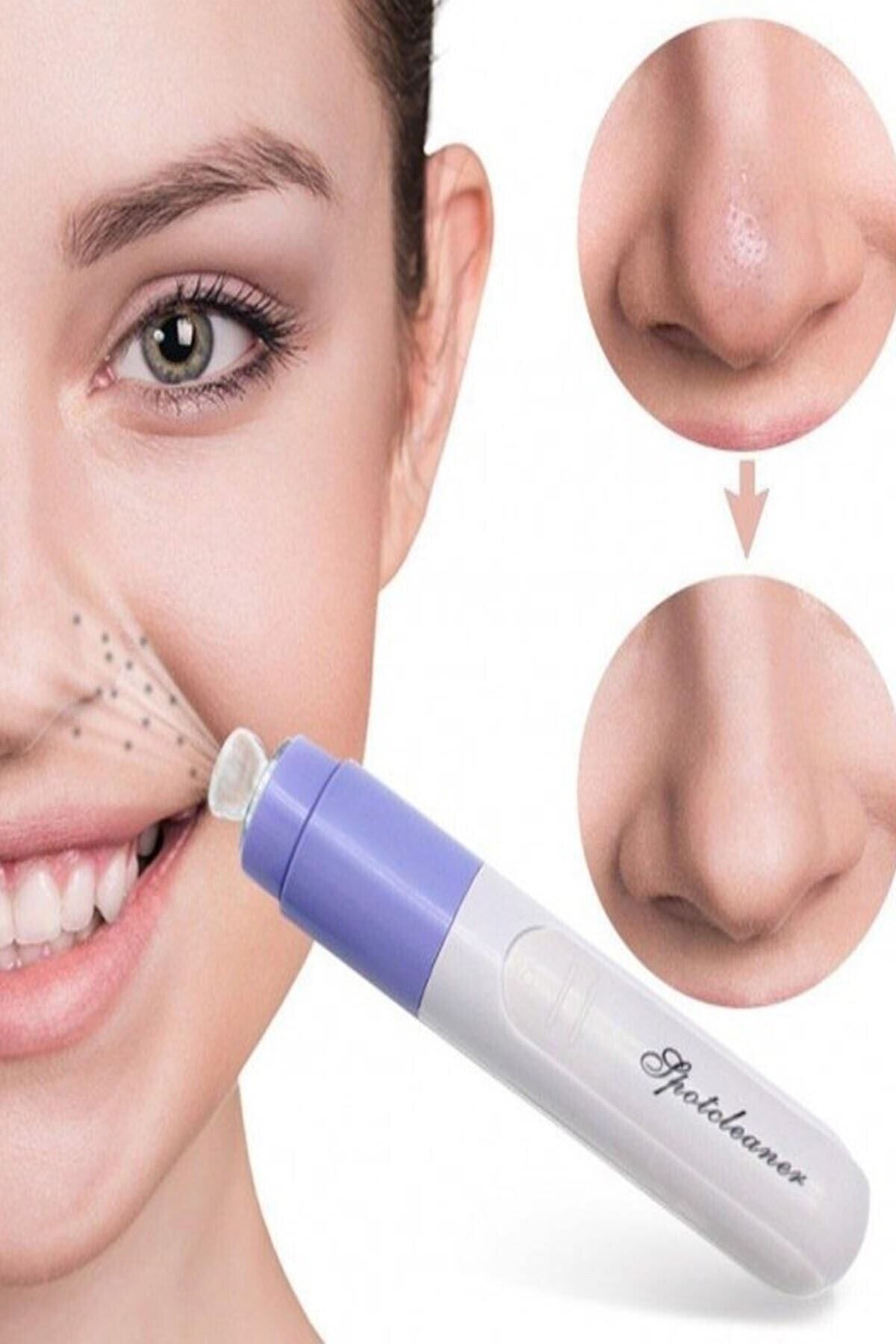 KAİZEN Pore Cleaner Vakumlu Yüz Temizleme Siyah Nokta Temizleme Cihazı