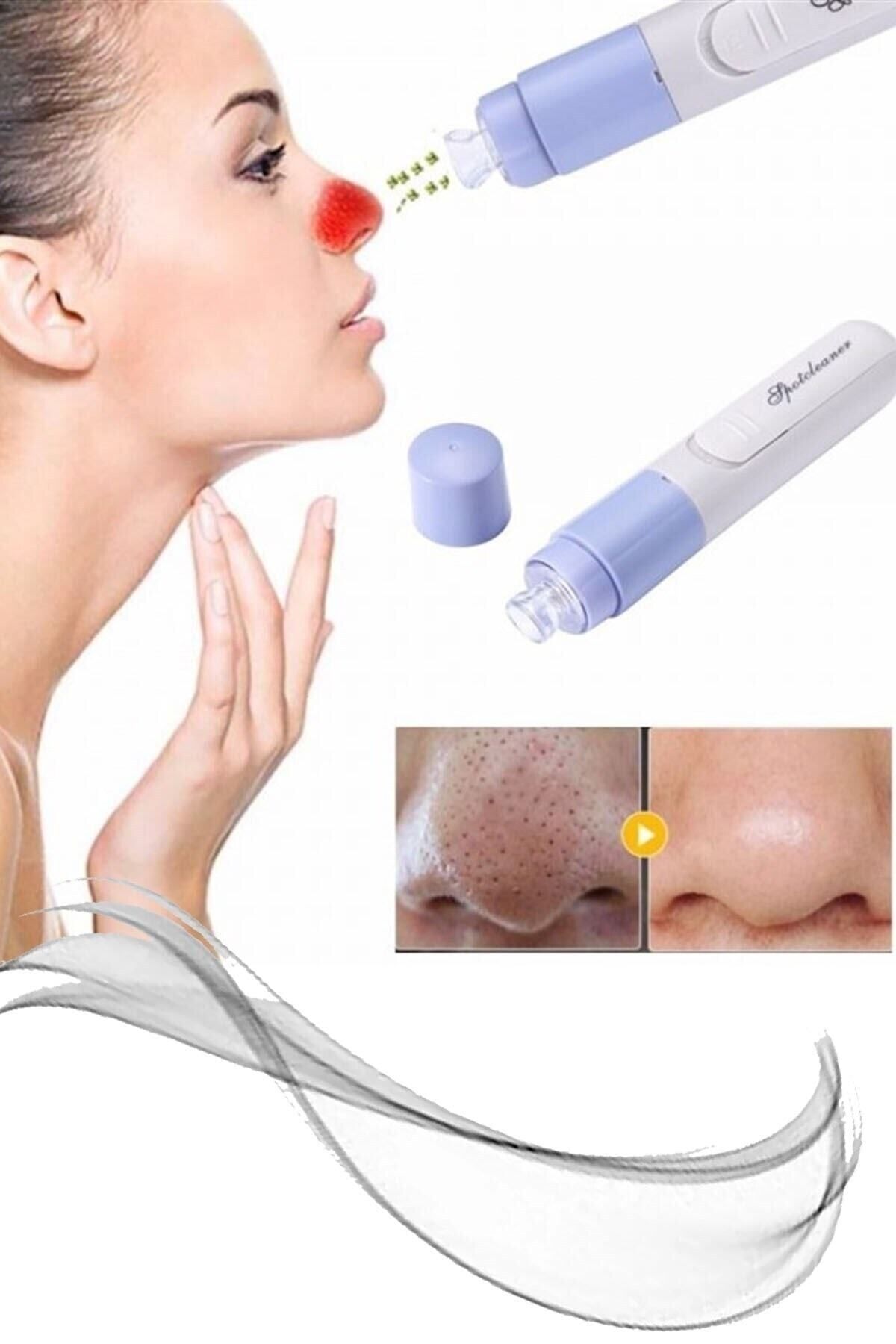 KAİZEN Pore Cleaner Vakumlu Yüz Temizleme Siyah Nokta Temizleme Cihazı