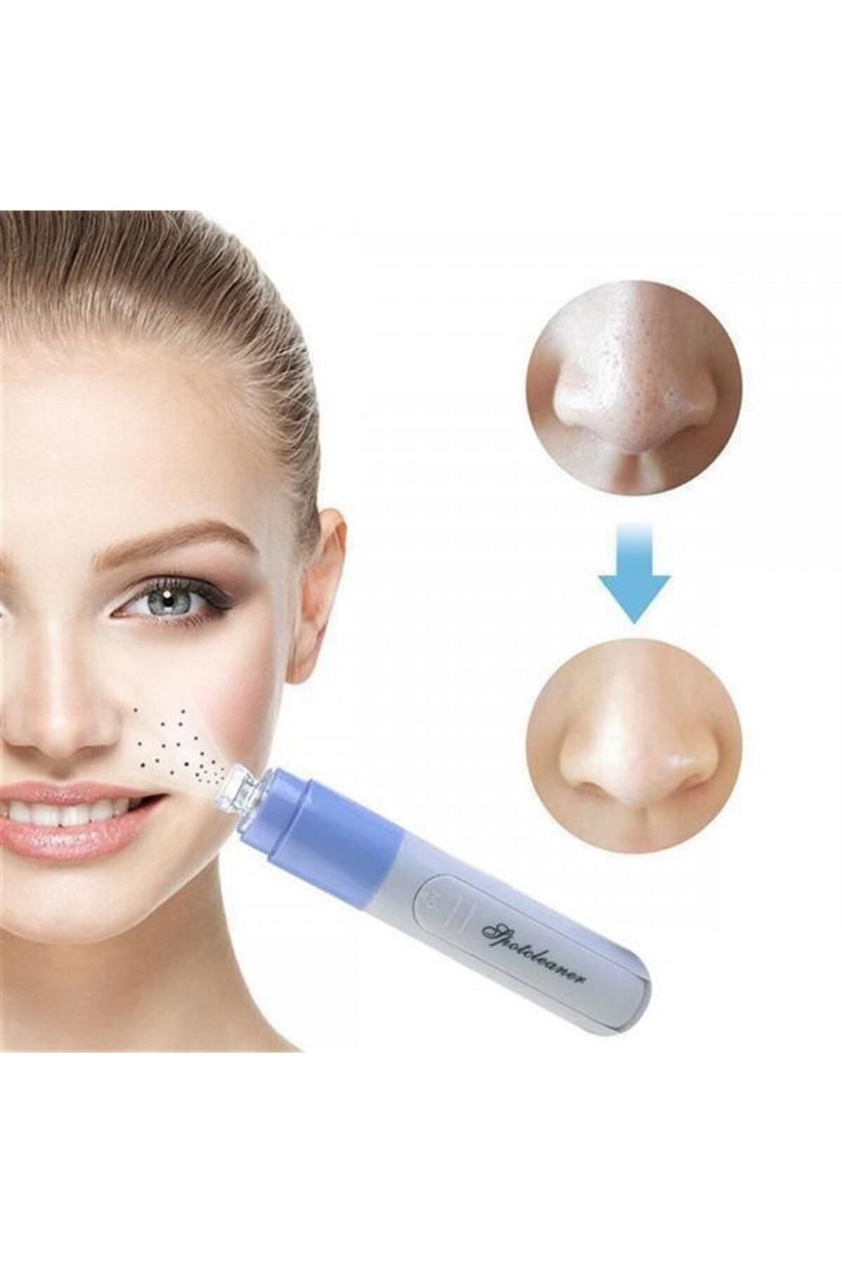 KAİZEN Pore Cleaner Vakumlu Siyah Nokta Yüz Temizleme Cihazı