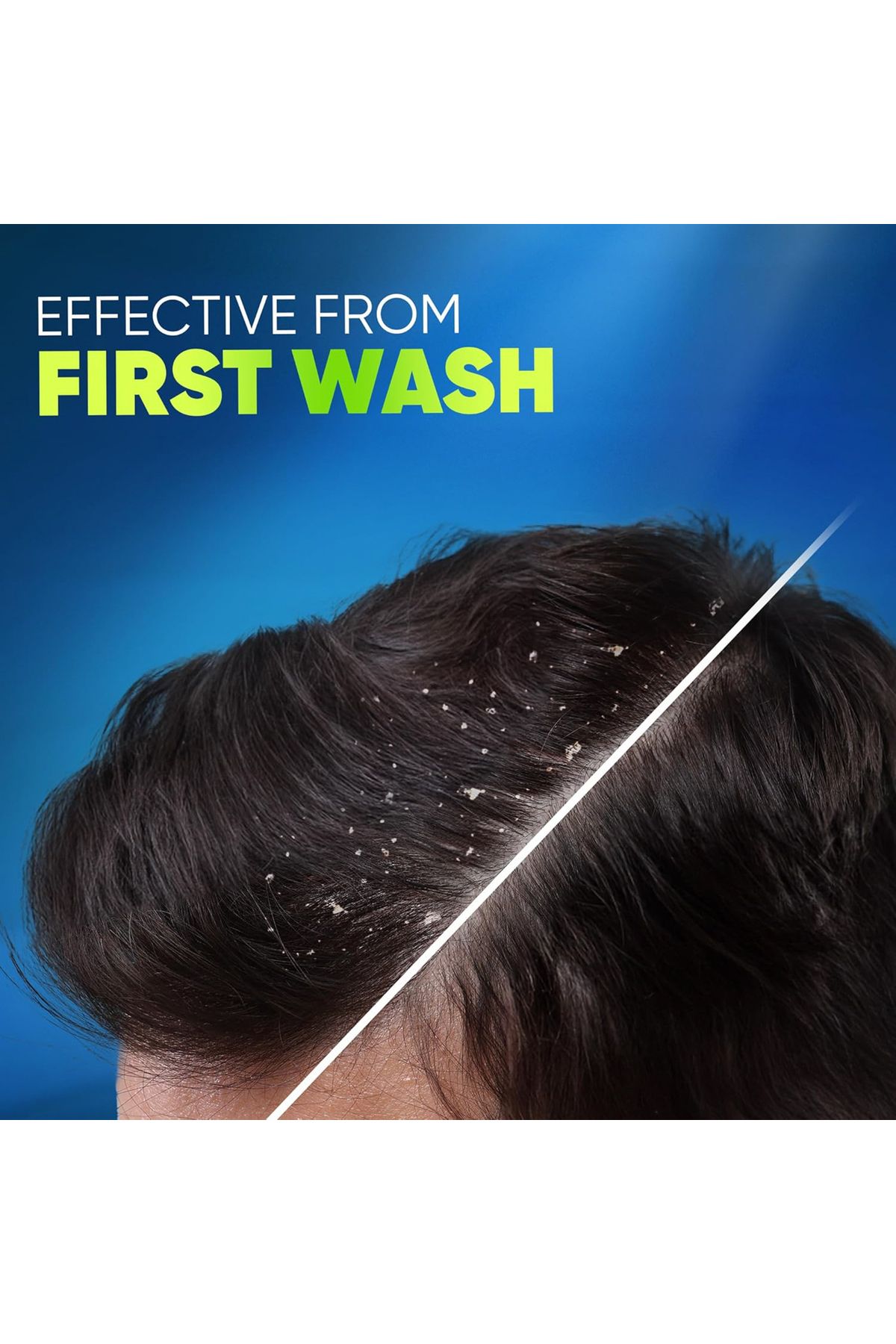 Head&Shoulders-Head & Shoulders Deep Clean Oily Scalp Citrus Anti-Dandruff Shampoo 400 ml 2