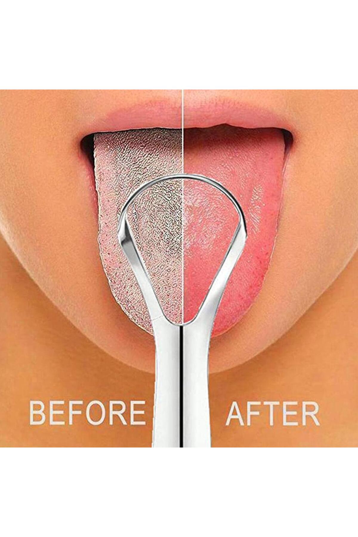 Choice 1Pcs Portable Single Layer Tongue Scraper Reusable Stainless Steel Ora...