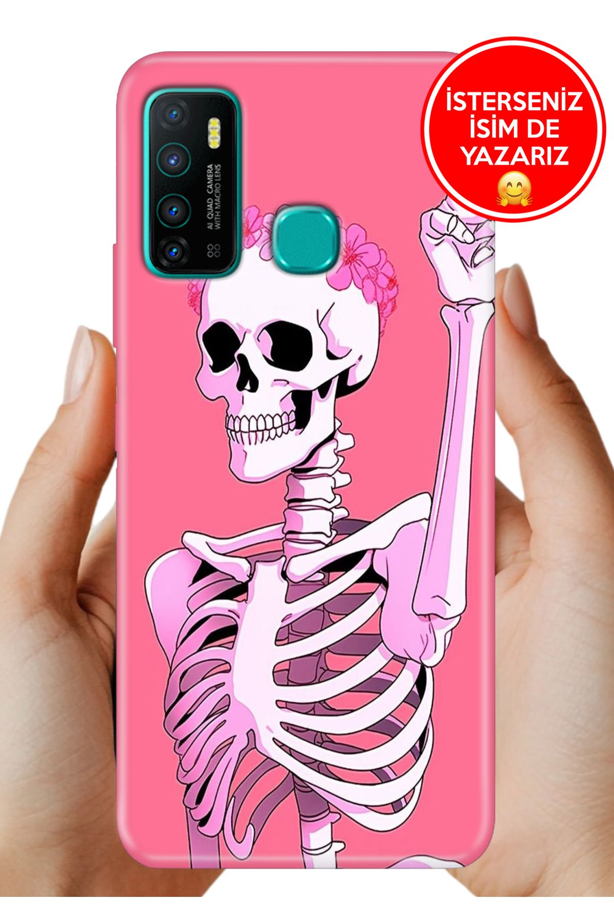 Cekuonline İnfinix Hot 9 Kılıf Hot 9 Kamera Koruma Vip-Seri Esnek Silikon Missskull