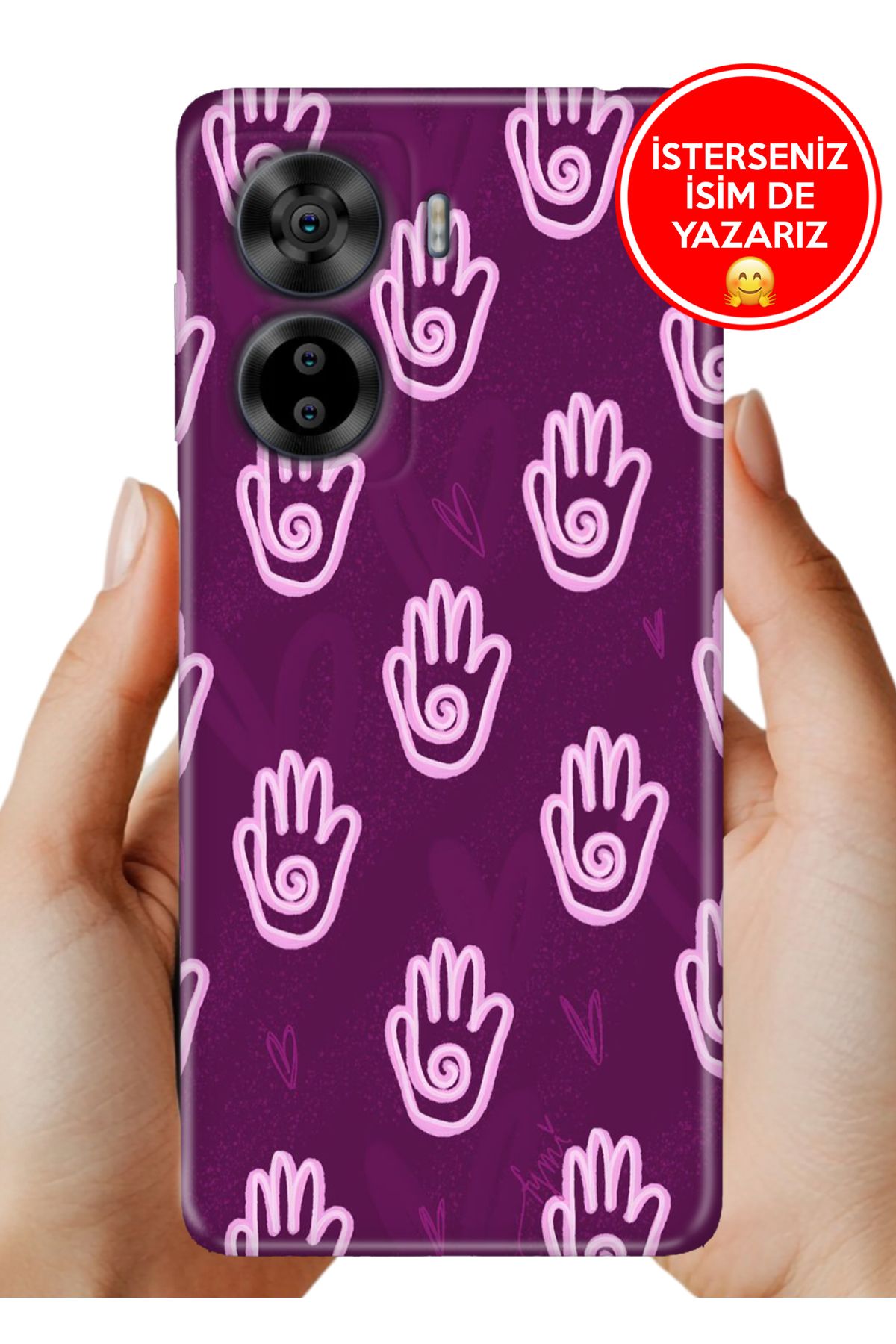 Cekuonline Casper Via X40 Kılıf Desenli Baskılı Kamera Korumalı Silikon My Hand
