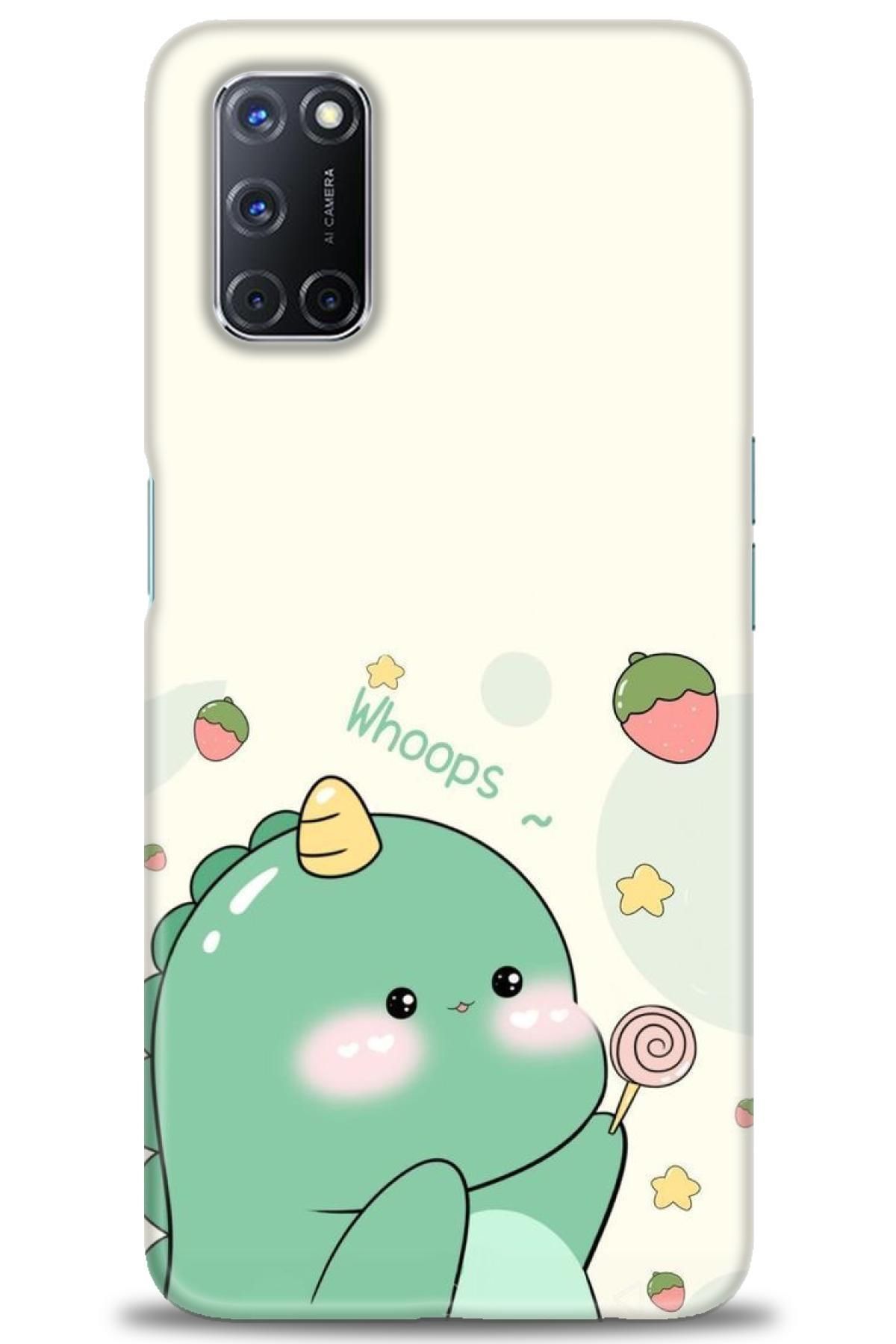 OPPO A52 / A72 / A92 İle Tam Uyumlu HD Baskılı Desenli Kılıf - Oppo - 587