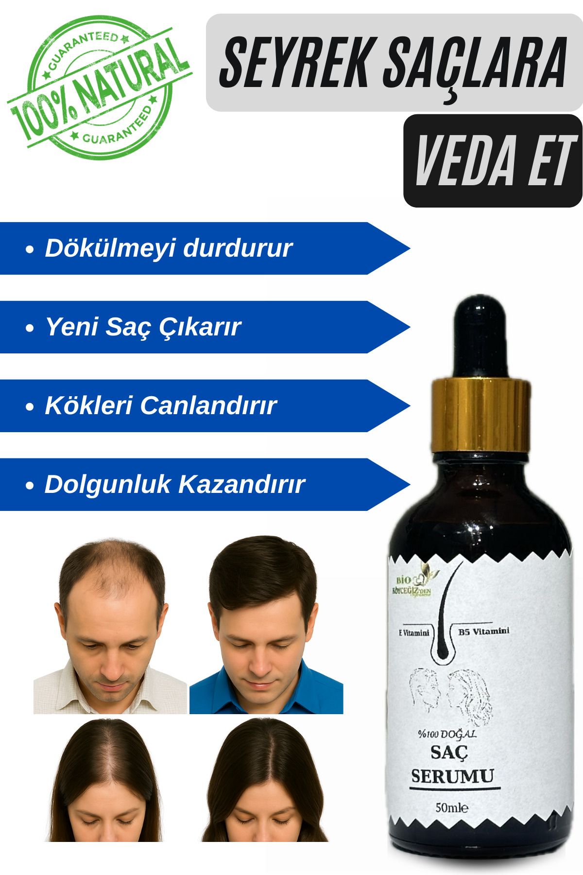 BİO KÖYCEĞİZDEN SOFRANIZA %100 Doğal Saç Serumu | Zencefil & Karanfil Özlü | Dökülme Karşıtı | Kadın & Erkek