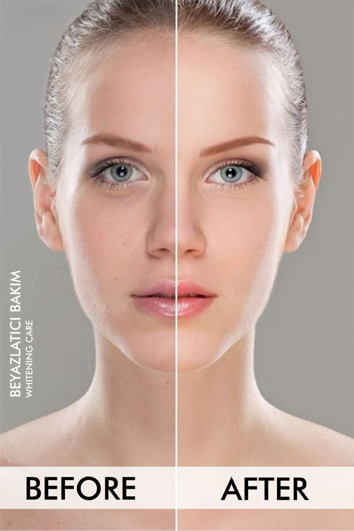Koltuk Altı-diz-dirsek Ve Bikini Bölgesi Cilt Beyazlatıcı Krem 100 ml Skin Whitening Cream — 73420102 — تصویر 4 از 5