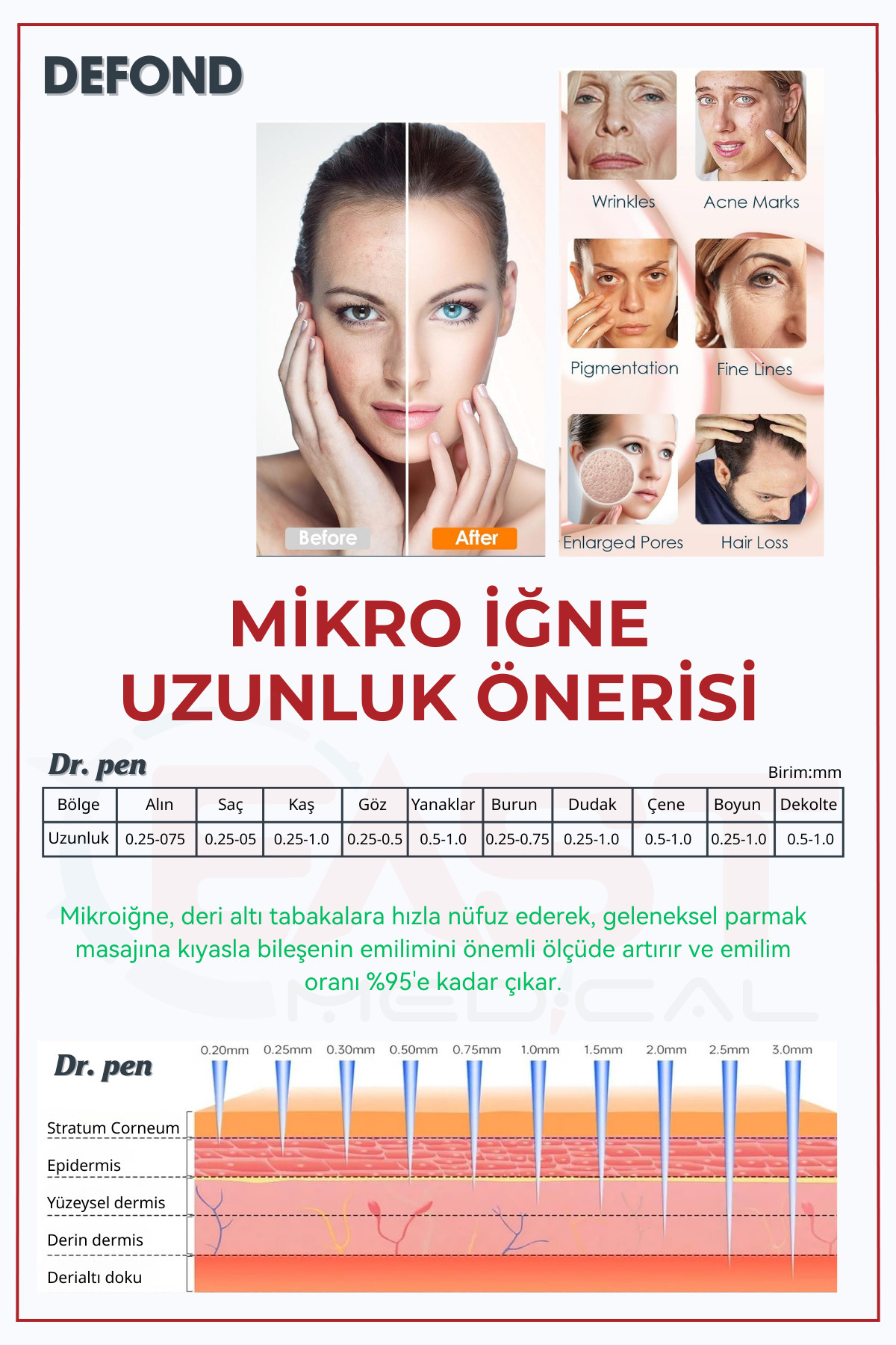 DEFOND-Dr Pen A6-A10-A1-N2-M5-M7-E30-Mym Compatible Needles 10 Pieces 9 Pin Original Dermapen Needle Cartridge 4
