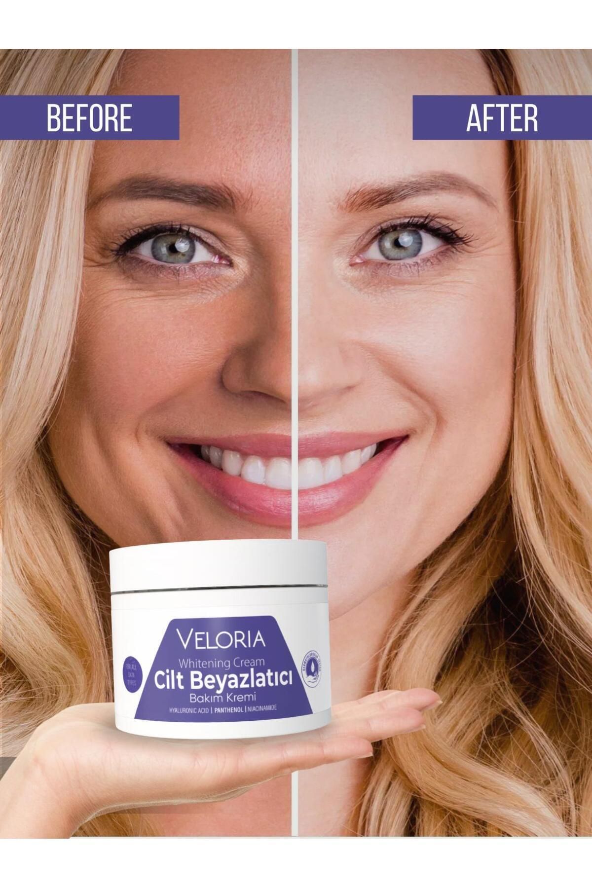Veloria Cosmetics Koltuk Altı-diz-dirsek Ve Bikini Bölgesi Cilt Beyazlatıcı Krem 100 ml Skin Whitening Cream
