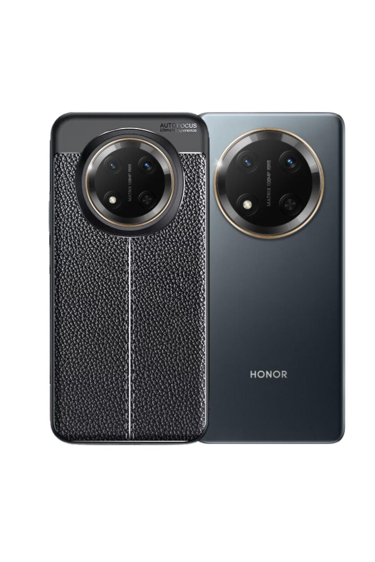 HANPORIUM Honor X60 Pro Uyumlu Silikon Kılıf Deri Desenli Darbe Emici Autofocus Tam Koruma Kapak