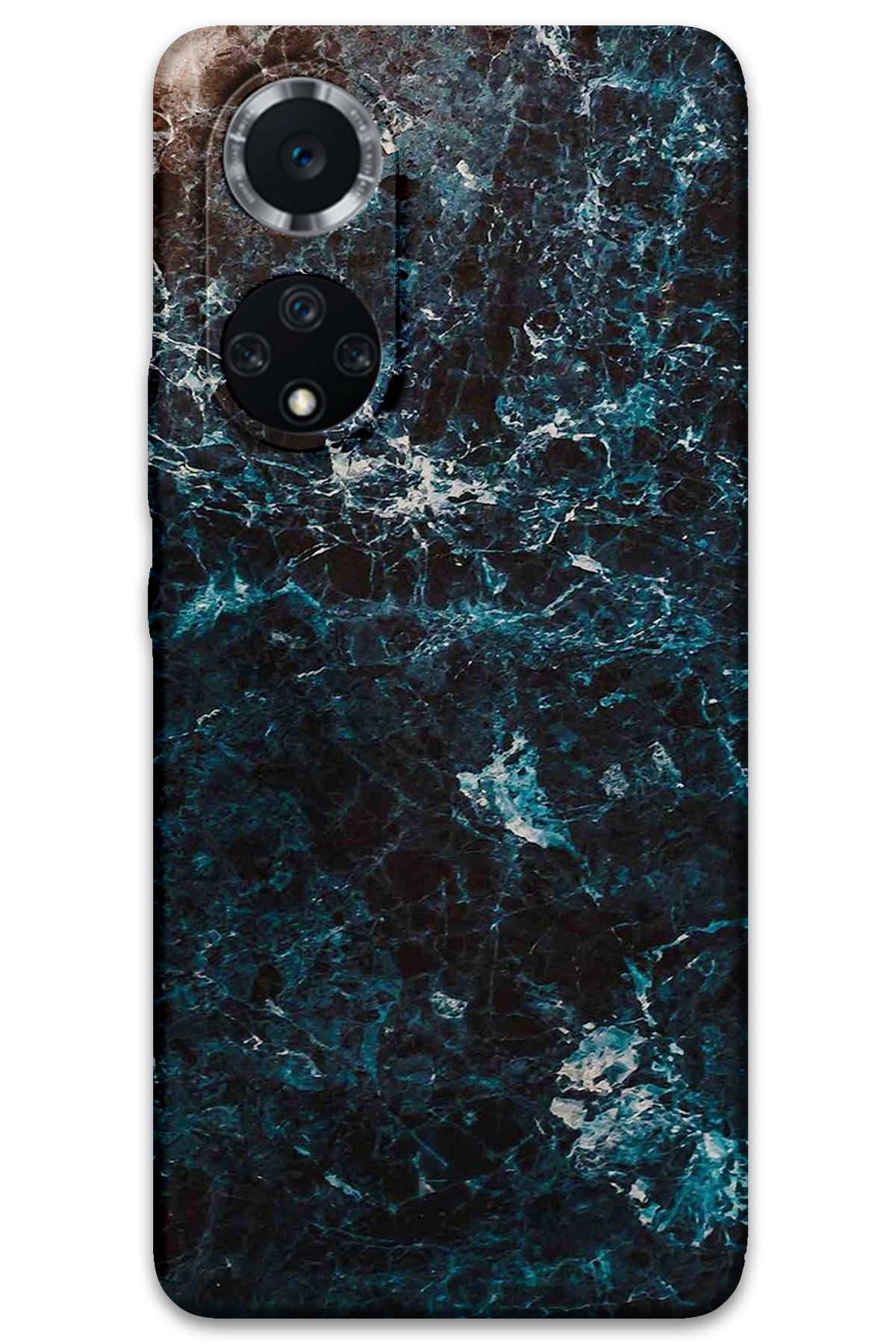 Gramaphone Huawei Nova 9 Uyumlu Mermer Desenli Telefon Kılıfı + Ekran Koruyucu - 5819