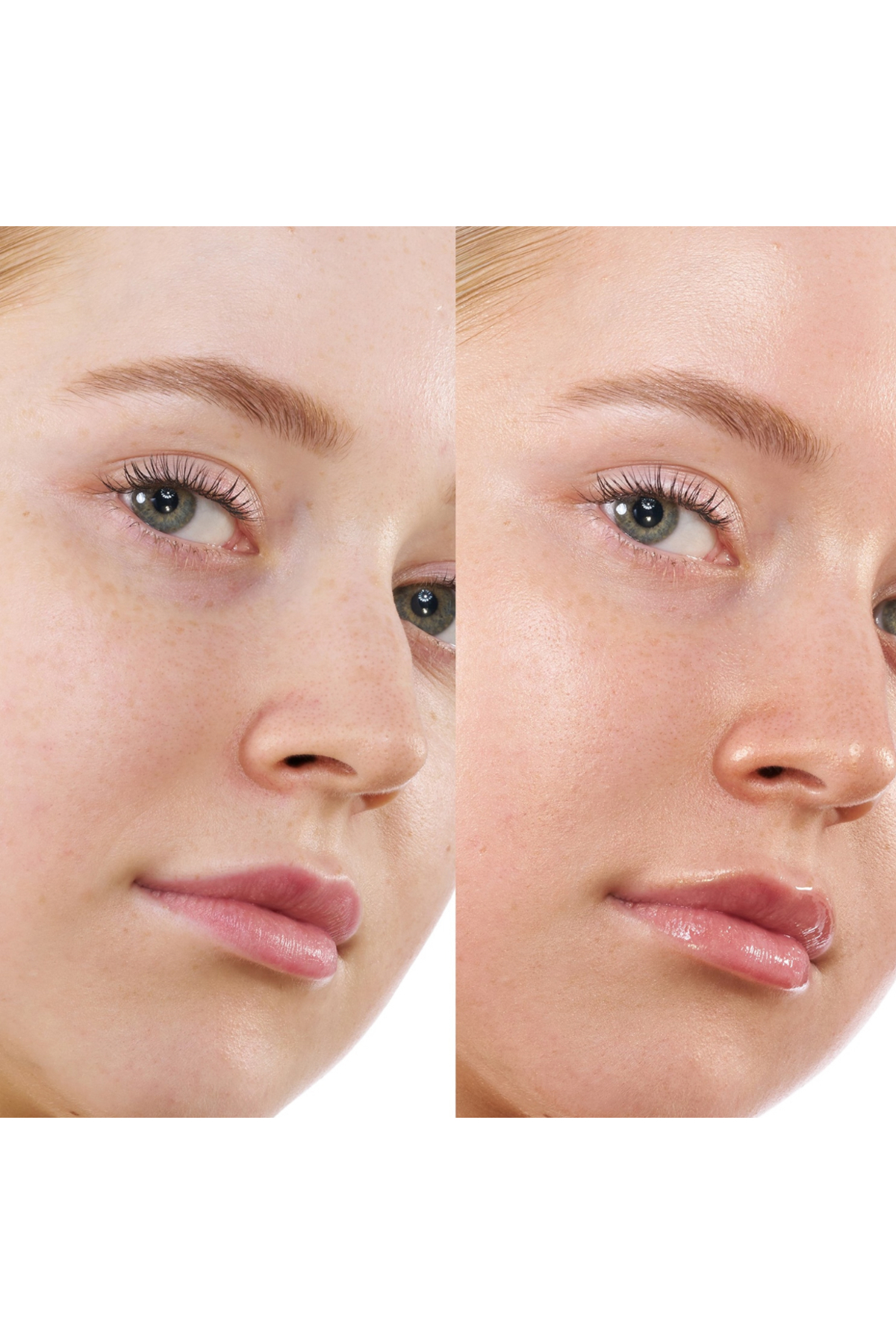 Hy-Gen Primer Serum Yüz İçin Makyaj Bazı Bronz Ve Işıltılı Görünüm Sunan Makyaj Bazı Elsbeauty — قهوه‌ای elsbeautyhygenserum18199292 — تصویر 2 از 4