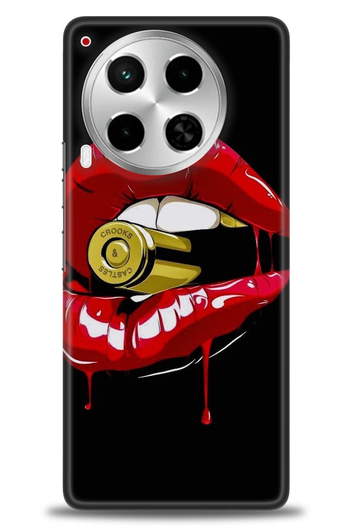 TECNO Spark 30 Pro İle Uyumlu HD Baskılı Kılıf - Karışık Seri - 793