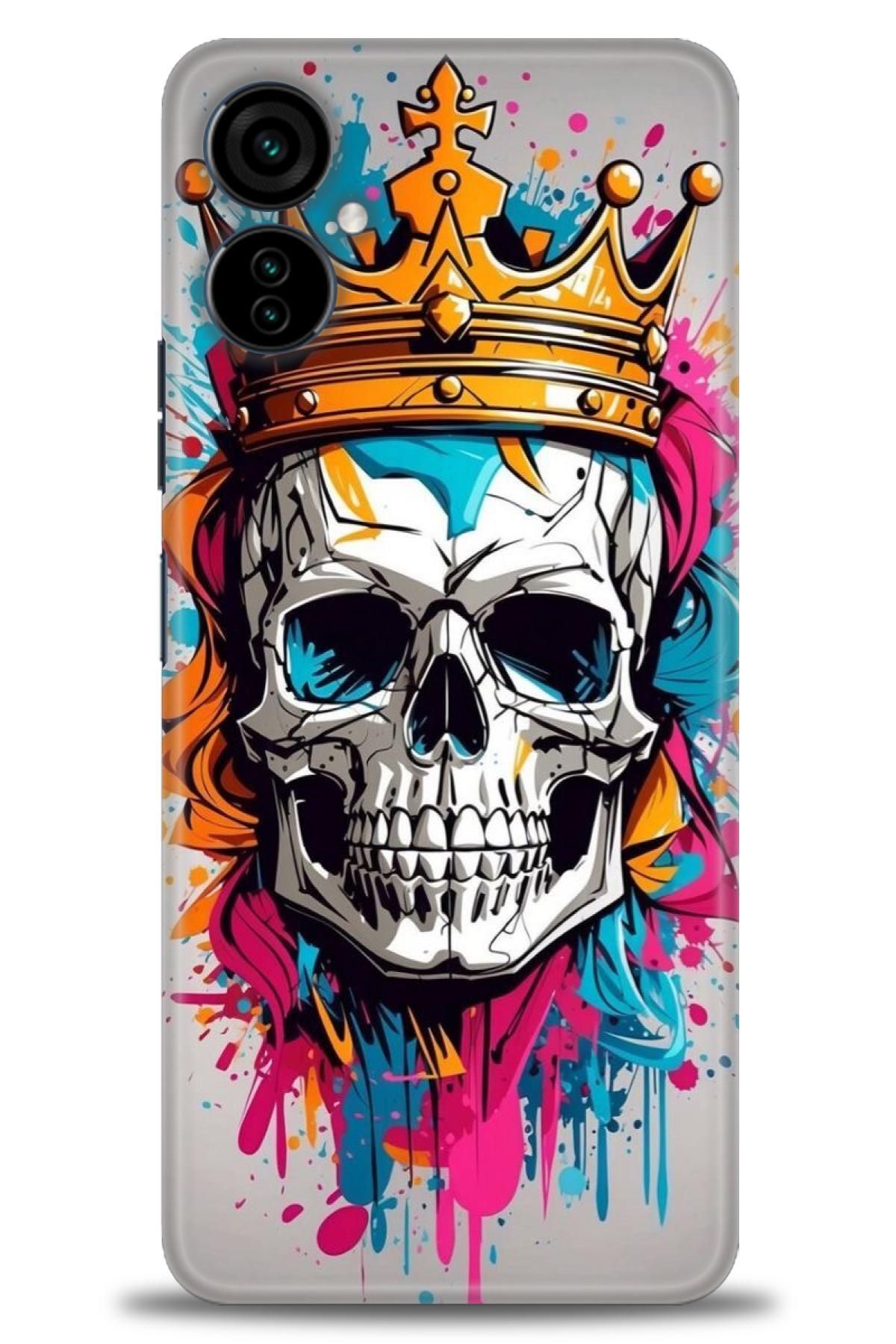 TECNO Camon 19 Neo (CH6i) İle Uyumlu HD Baskılı Kılıf - Karışık Seri - 993