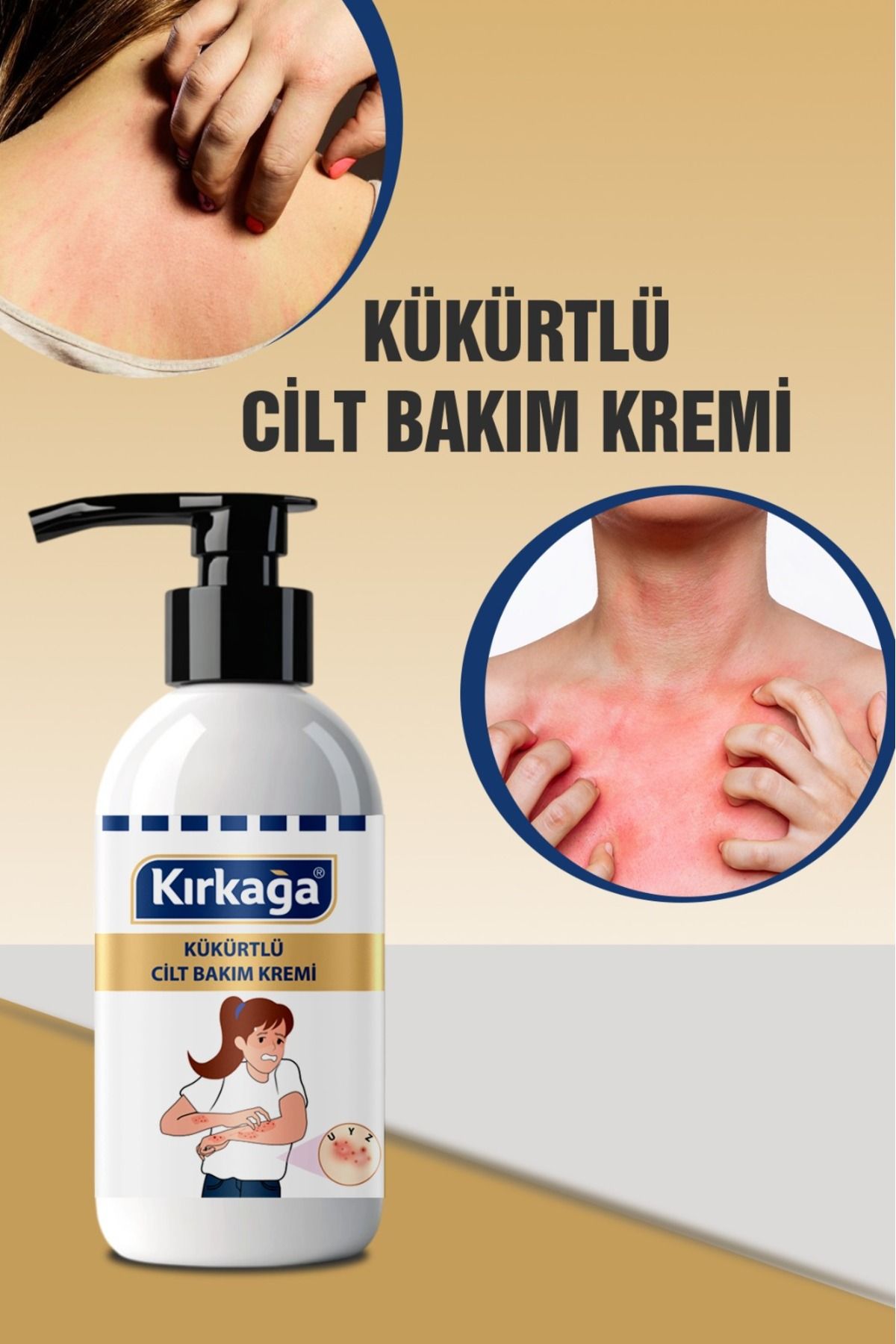 Kırkağa Karşıtı Cilt Losyonu 150 ml – Onarıcı ve Yatıştırıcı Etki
