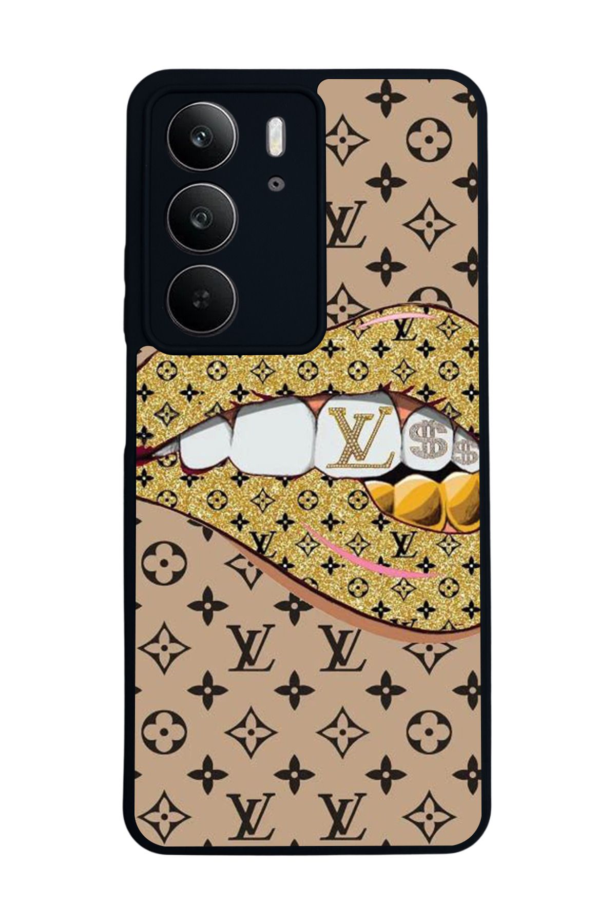 realme C75 Mat Uyumlu Siyah Kılıf – Yumuşak Silikon, Koruyucu, Şok Emici Kapak