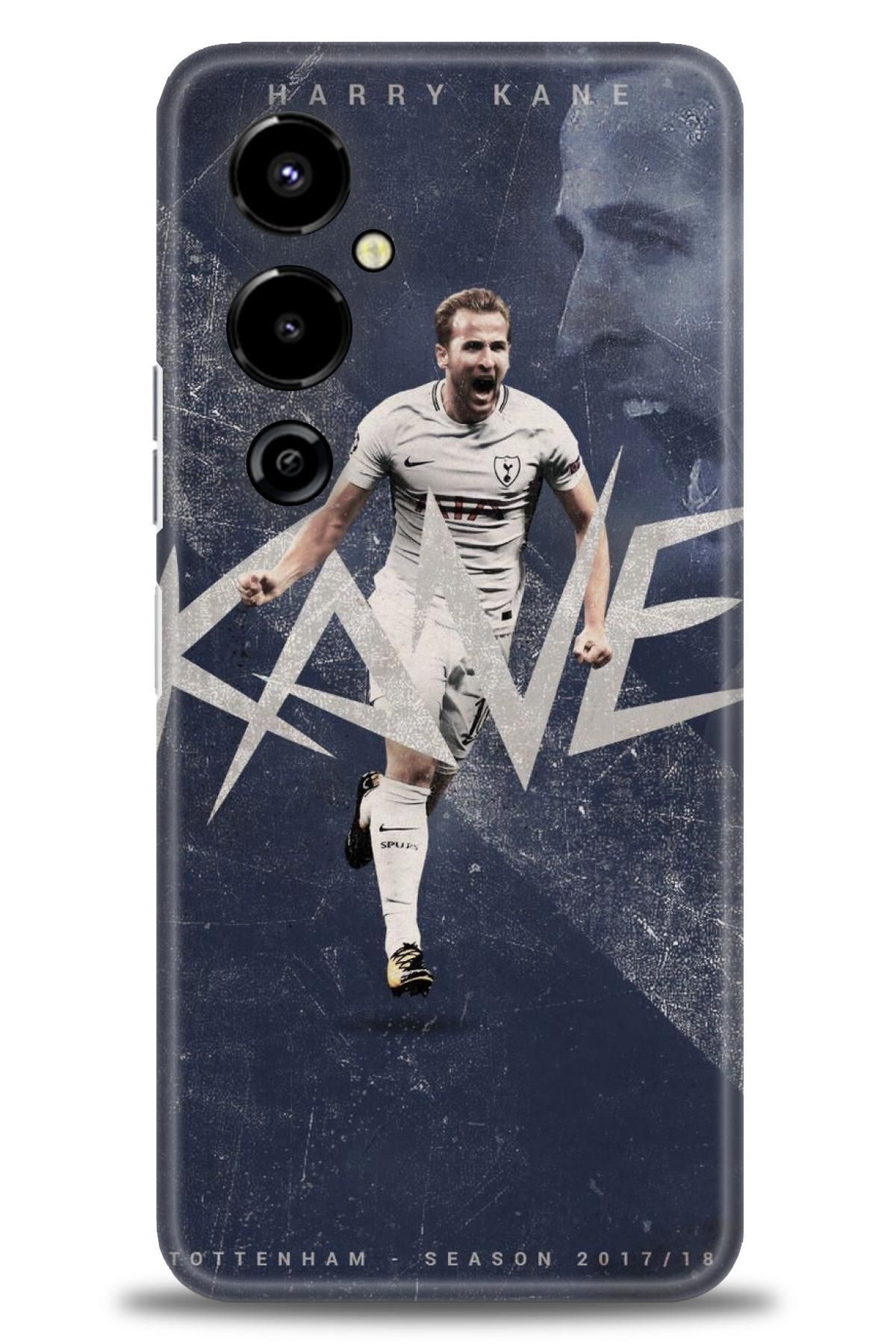 TECNO Camon 40 Pro 5G İle Uyumlu HD Baskılı Kılıf - Karışık Seri - 141