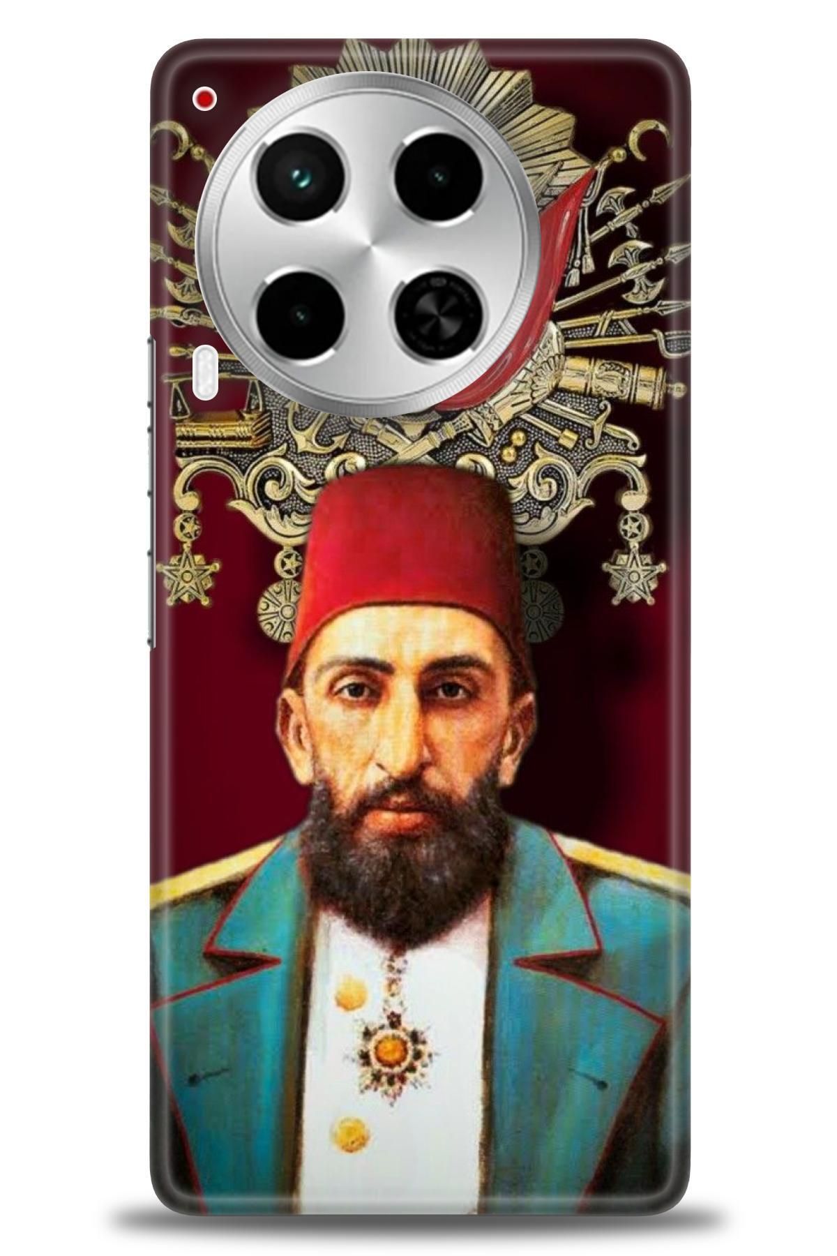 TECNO Camon 30 (CL6) İle Uyumlu HD Baskılı Kılıf - Karışık Seri - 1063