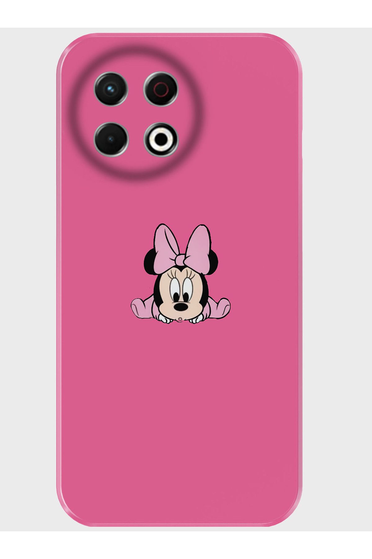 Activist Tecno Spark 30 Pro Kılıf Kamera Korumalı Baskılı Silikon Kapak - babyminymouse