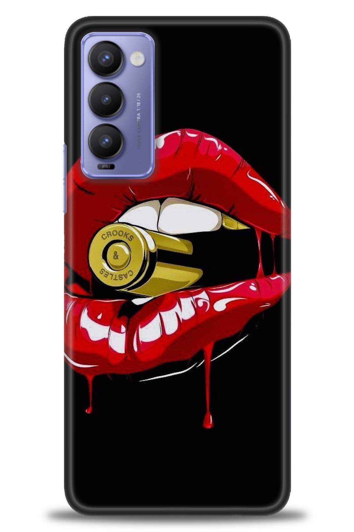 TECNO Camon 18 / 18P (CH6n - CH7n ) İle Uyumlu HD Baskılı Kılıf - Karışık Seri - 793