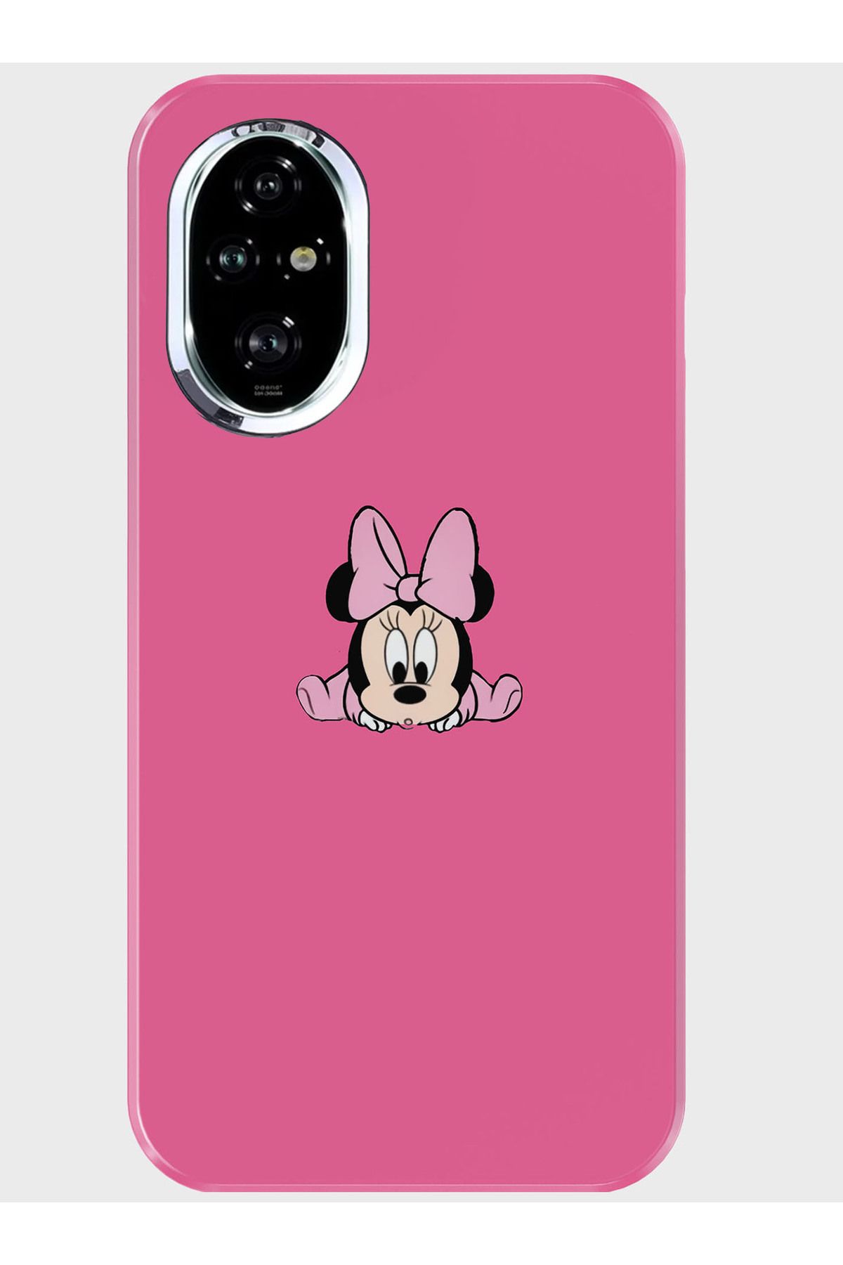 Activist Honor 200 Pro Kılıf Kamera Korumalı Baskılı Silikon Kapak - babyminymouse