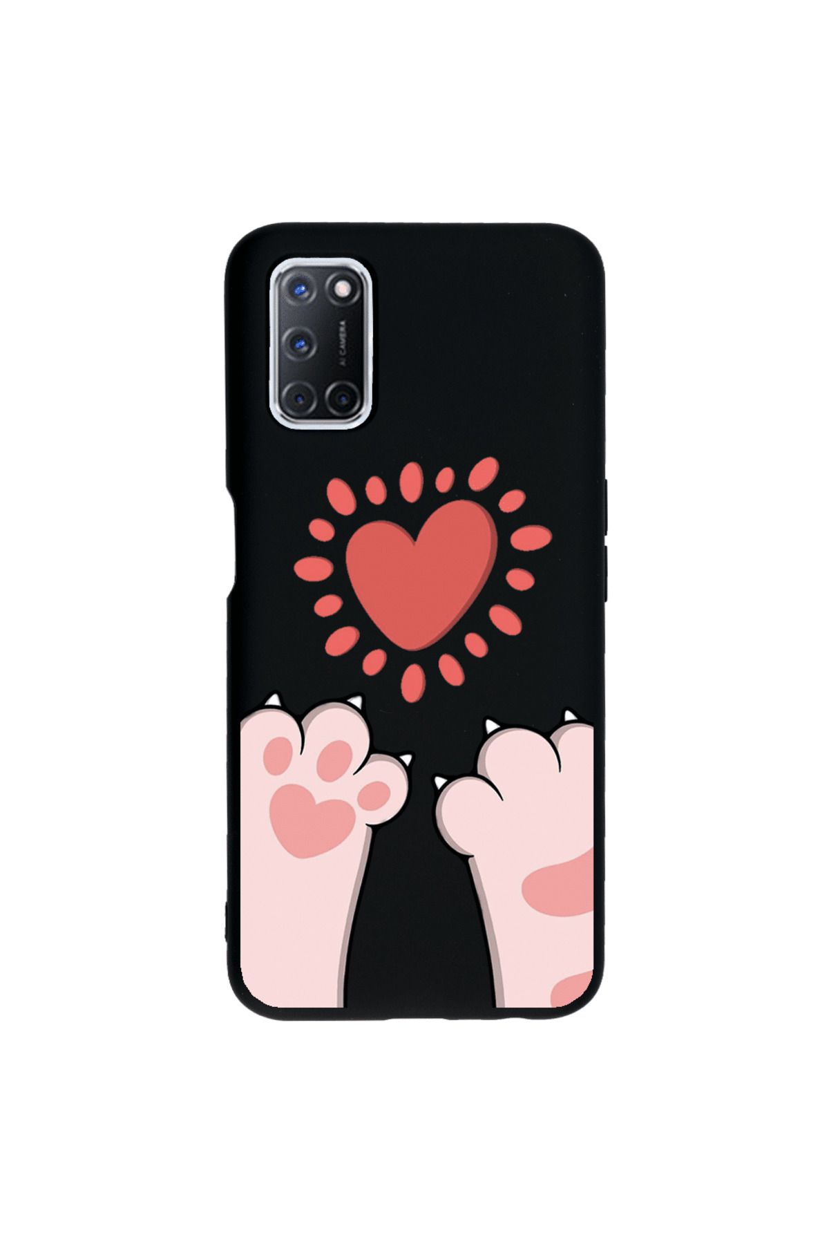 Royaleks Oppo A72 Lansman Kılıf - Pati