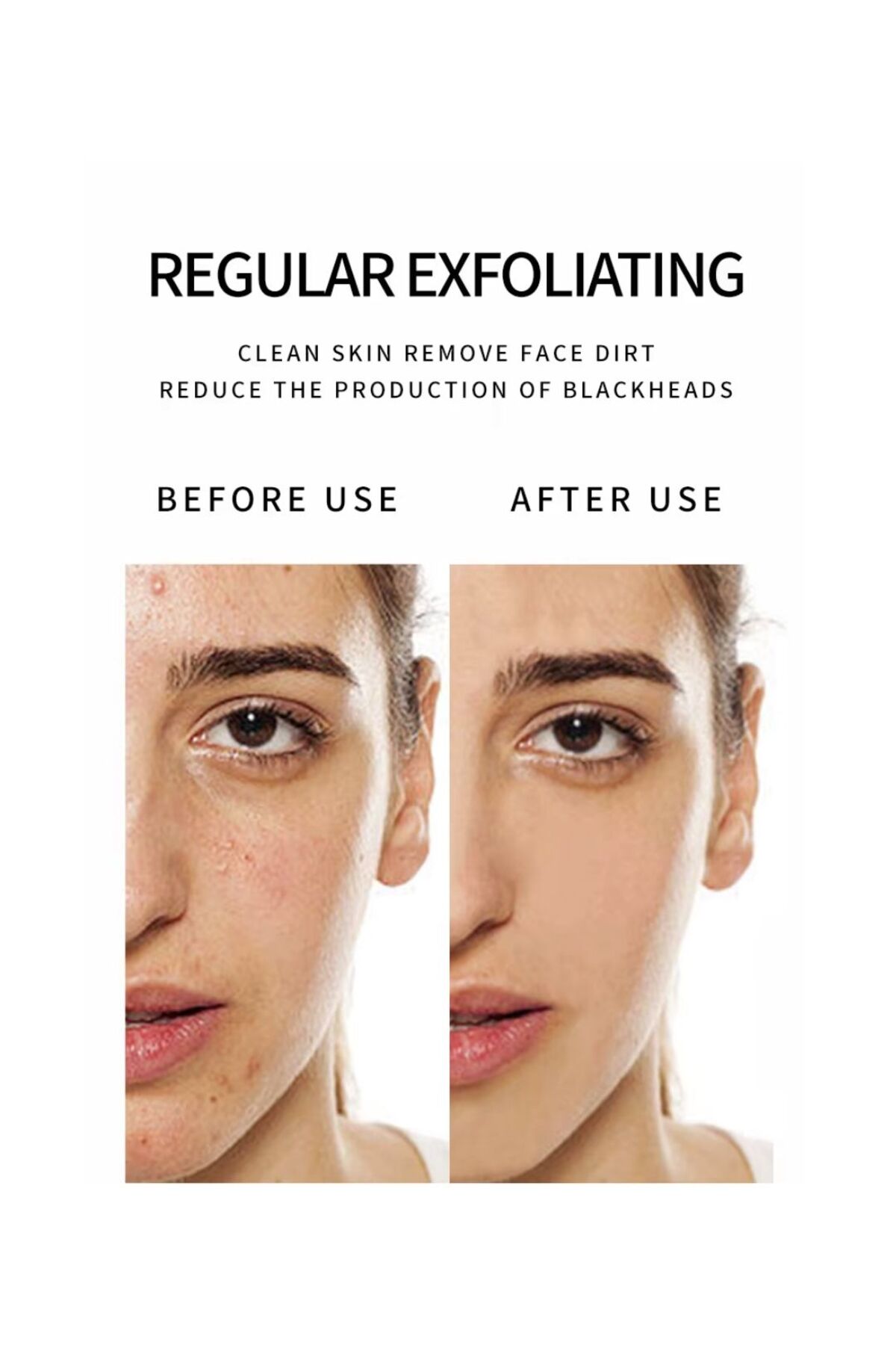 Gözenek Sıkılaştırıcı Ve Pürüzsüzleştirici Aloe Vera & E Vitaminli Yüz Peelingi 220gr (1ADET) — DRL-1775-T — تصویر 4 از 7