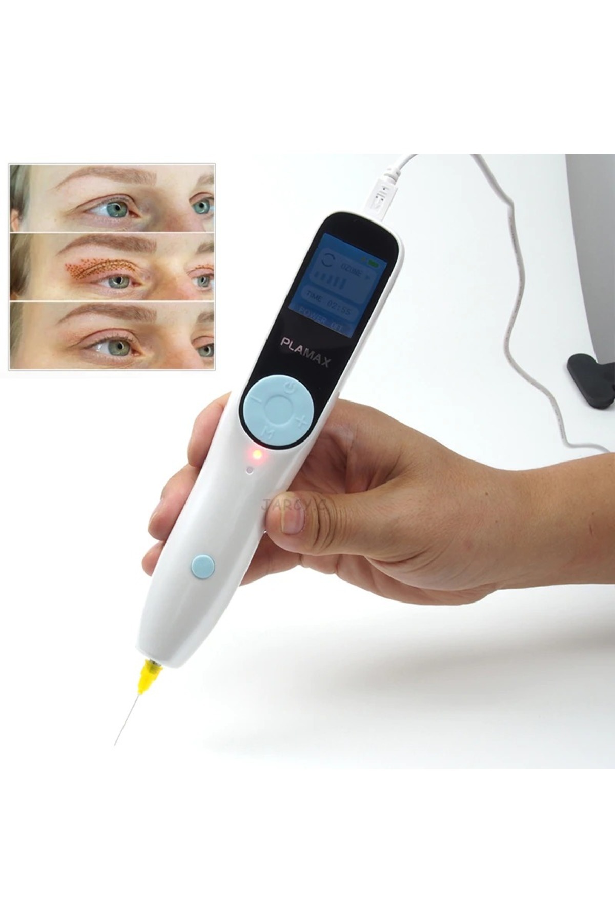 Yeni Dövme Silme Plazma Cihazı Siyah Nokta Iz Leke Ben Çil Mantar Silme Çıkarma Aleti Tattoo Remover — LESC33 — تصویر 5 از 7