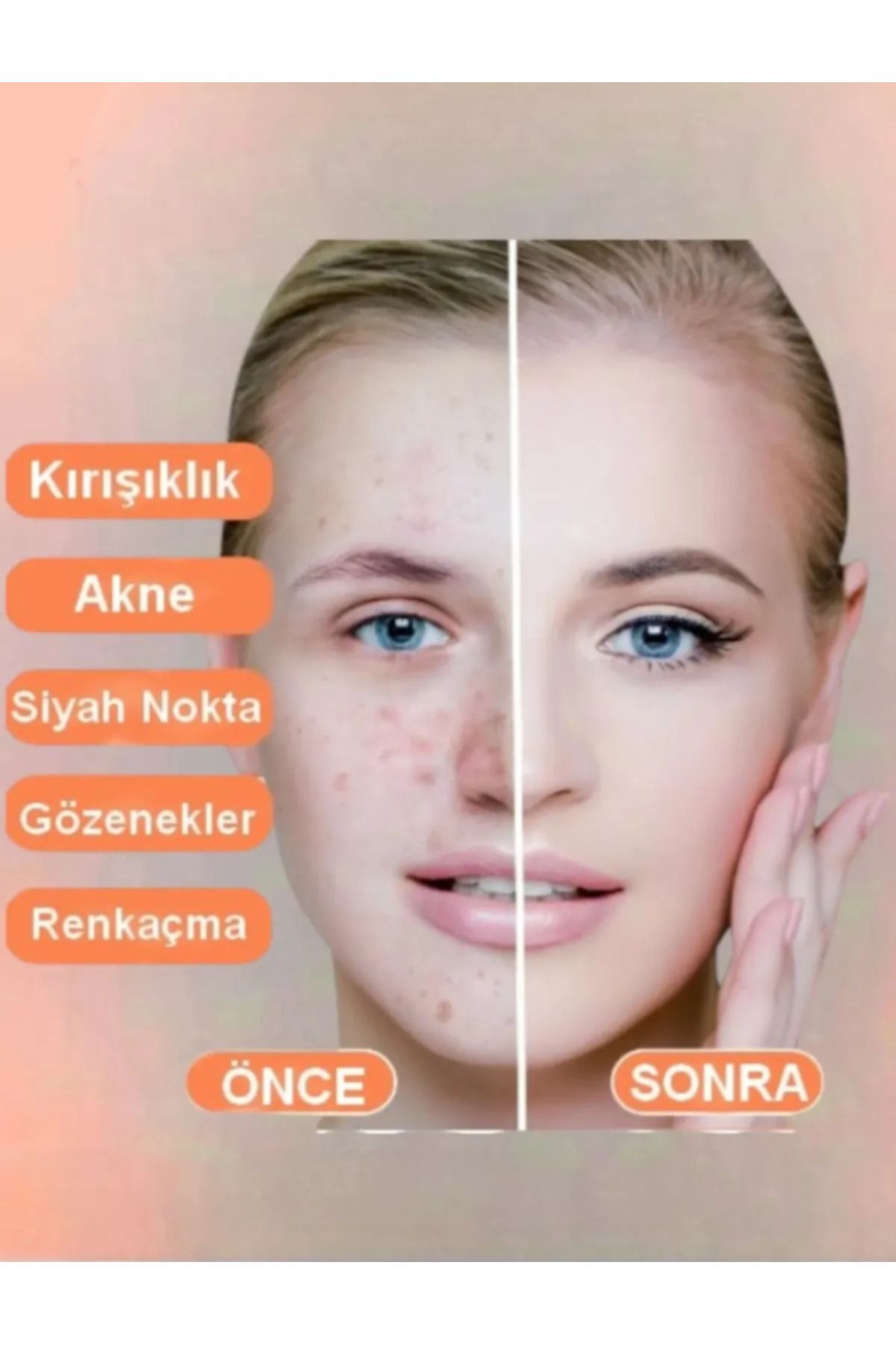 Home Kojic Asit Sabunu, Zerdeçal Ve Kojik Asit Etkisi Ile Leke Karşıtı Kojik Asit Sabunu 120 gr (1 ADET)