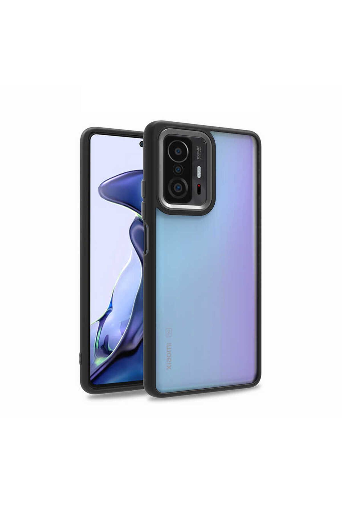 YTSGLOBAL Mi 11T Pro 5G Kılıf YTSG Flora Kapak - Siyah