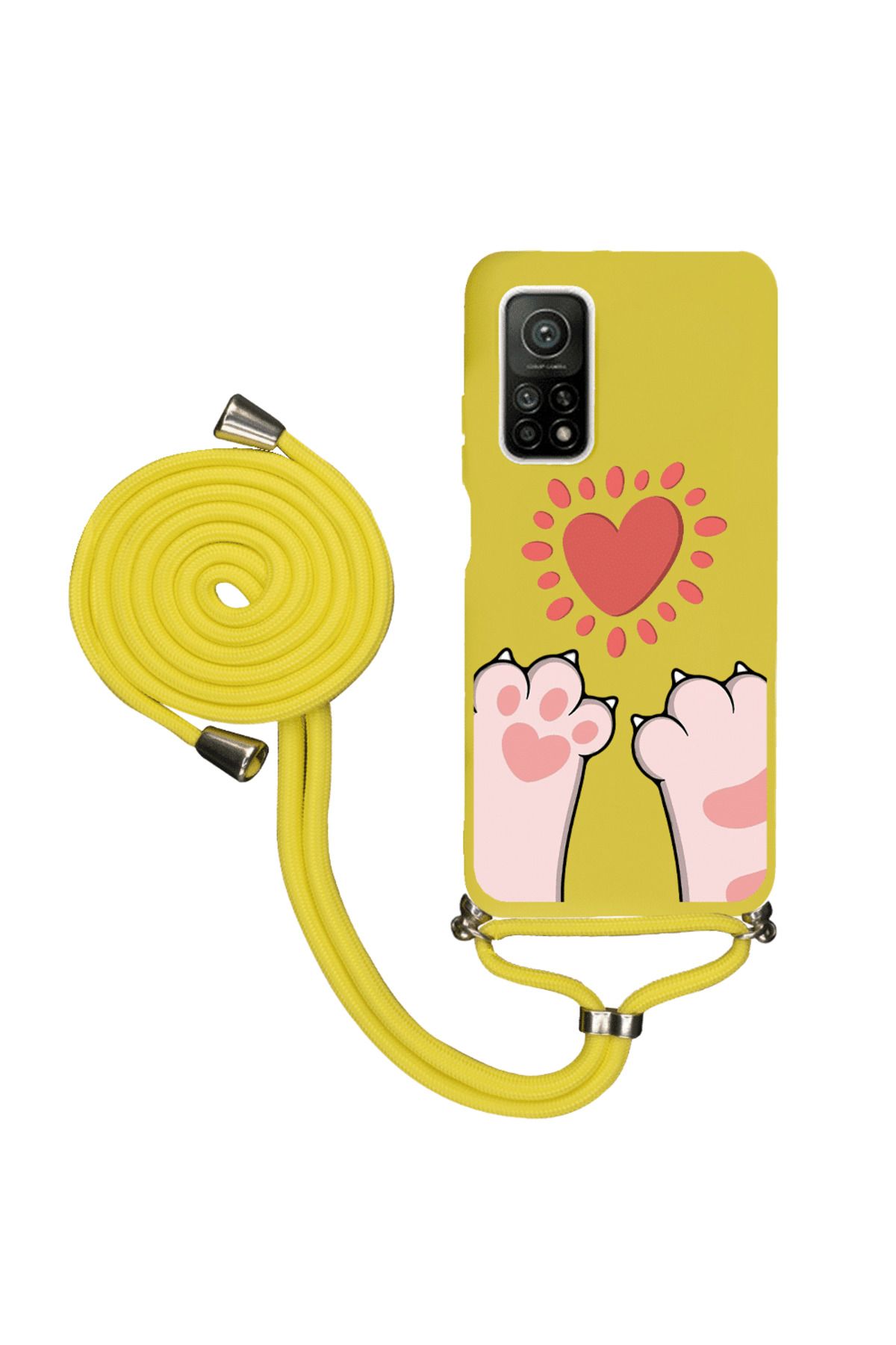 Royaleks Xiaomi Mi 10T İpli Lansman Kılıf - Pati