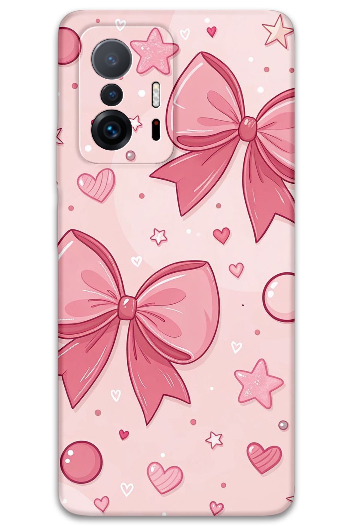 Gramaphone Xiaomi Mi 11T Pro Uyumlu Kurdele Desenli Telefon Kılıfı + Ekran Koruyucu - 5803