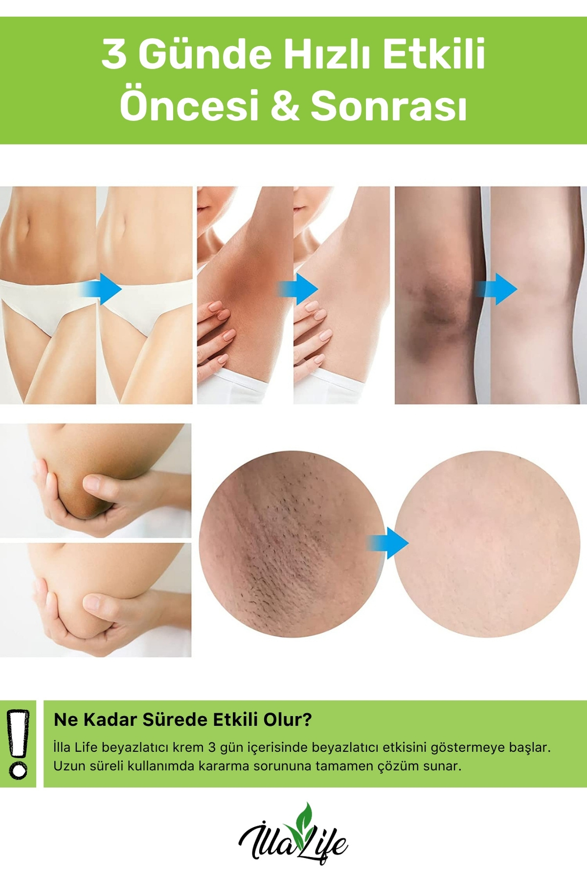 İlla Life-Private Area - Fast-Acting Whitening Underarm Bikini Area 3