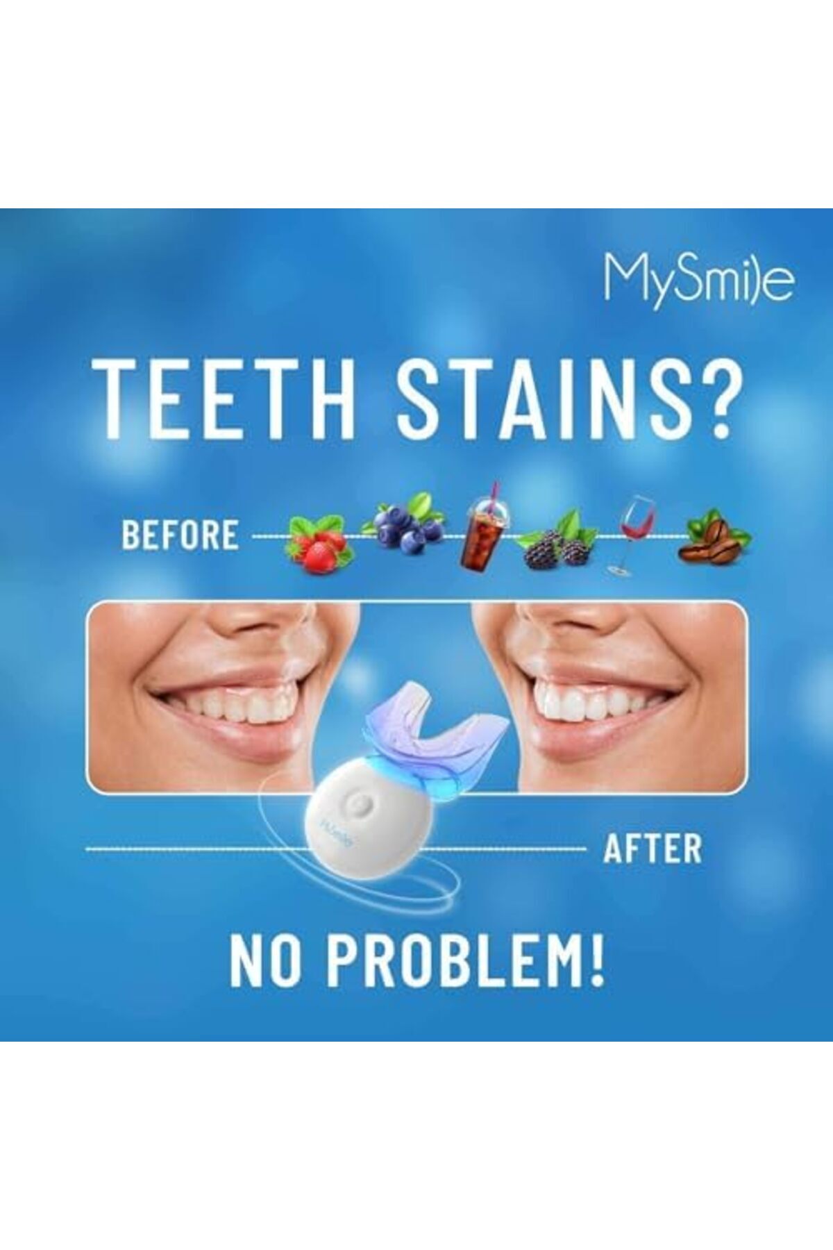 mysmile-Teeth Whitening Kit with LED Light, 10 Min Non-Sensitive Fast Teeth Whitener with 3 Carbamid 5