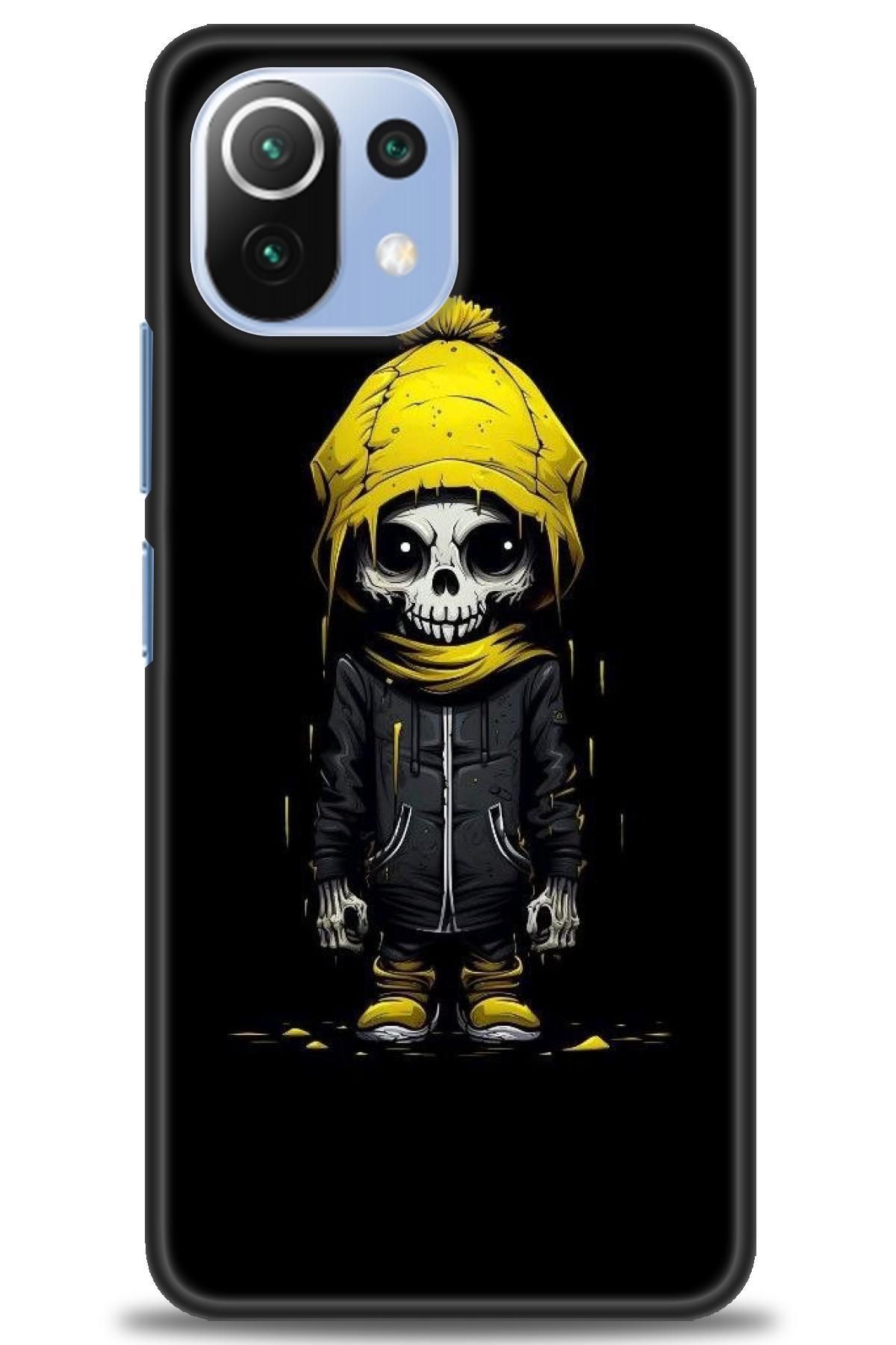CooperTech Xiaomi Mi 11 Lite İle Uyumlu HD Baskılı Desenli Silikon Kılıf - 432