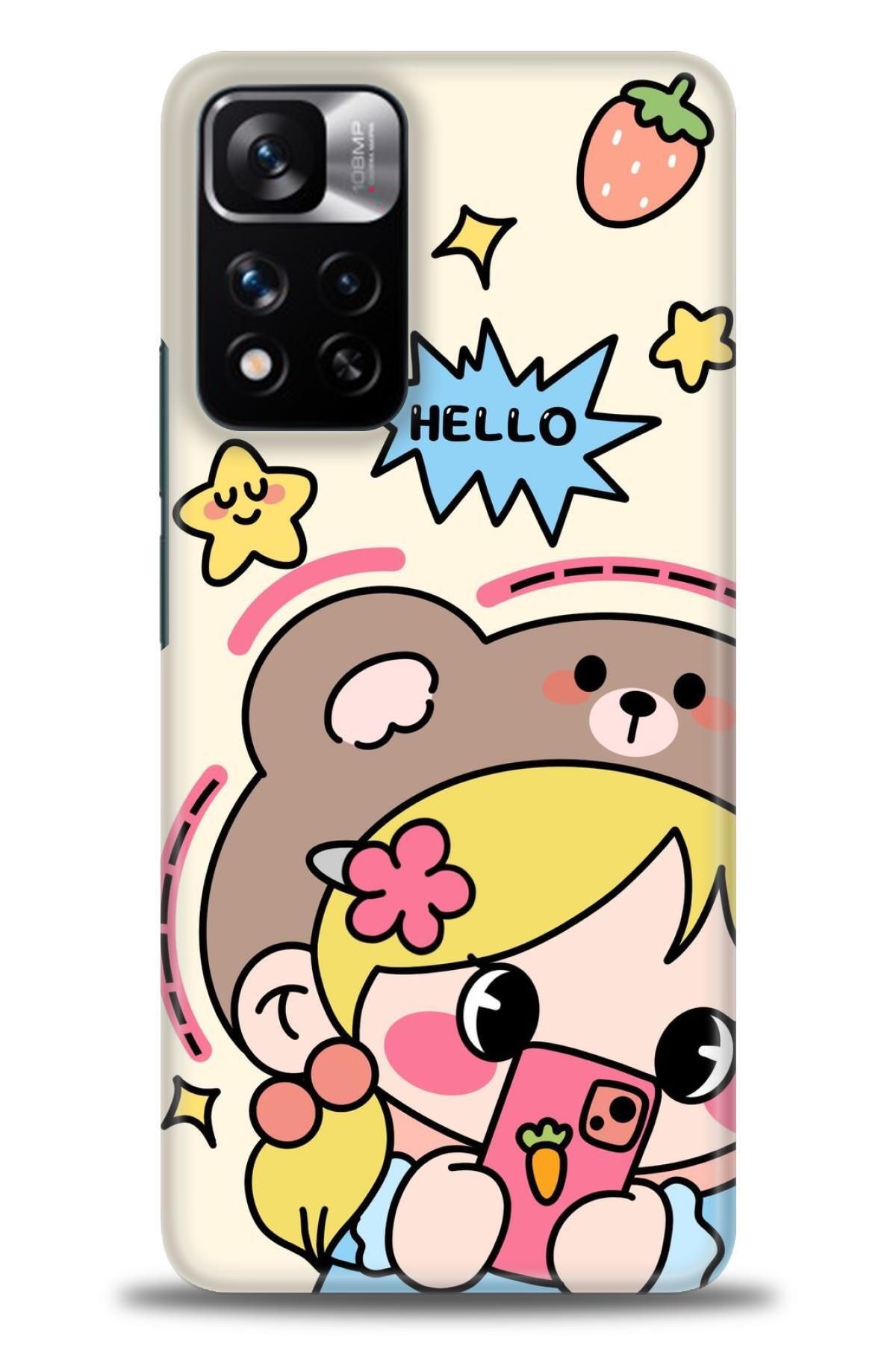 CooperTech Xiaomi Redmi Note 11 Pro Plus İle Uyumlu HD Baskılı Desenli Silikon Kılıf - 32
