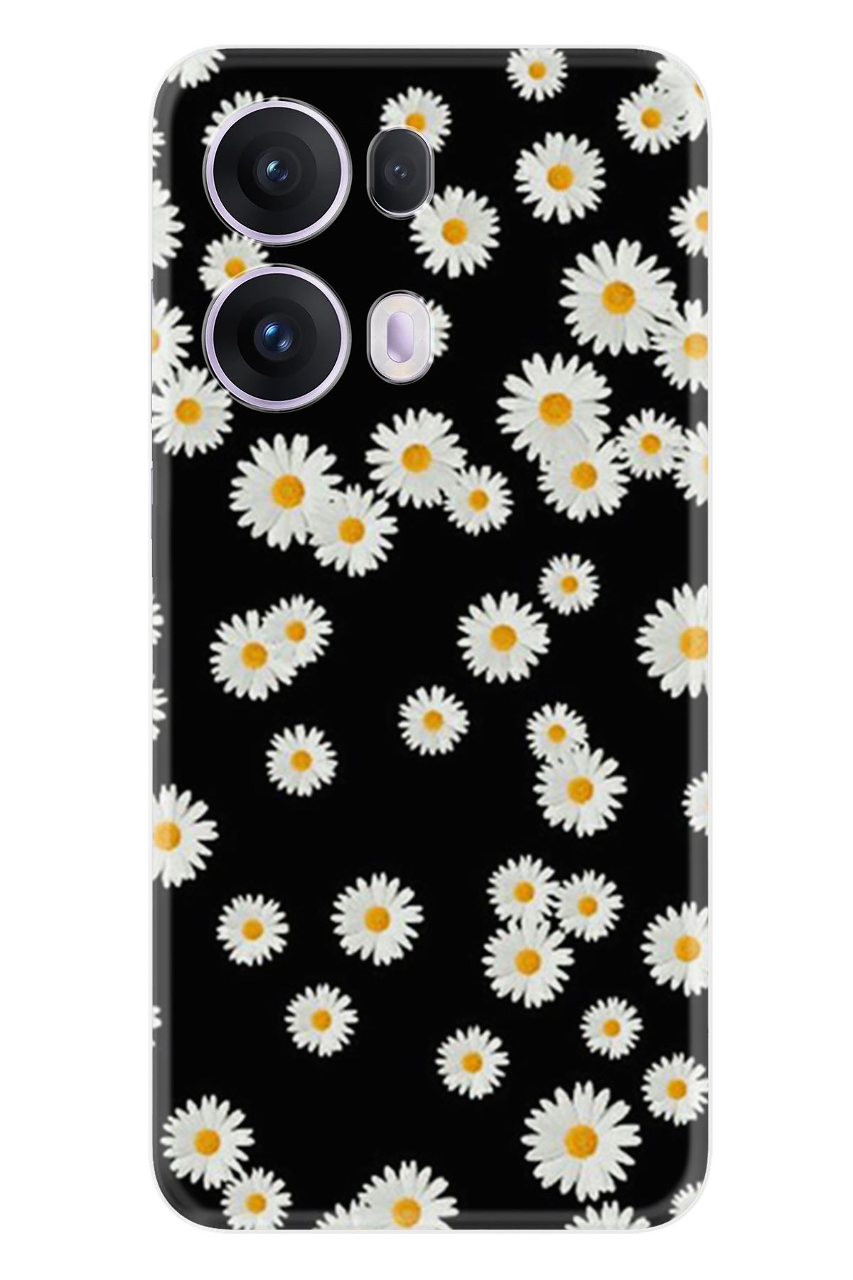 Kılıfland Oppo Reno 13 Pro Kılıf Boutique Baskılı Resimli Papatyalar Pcode -018