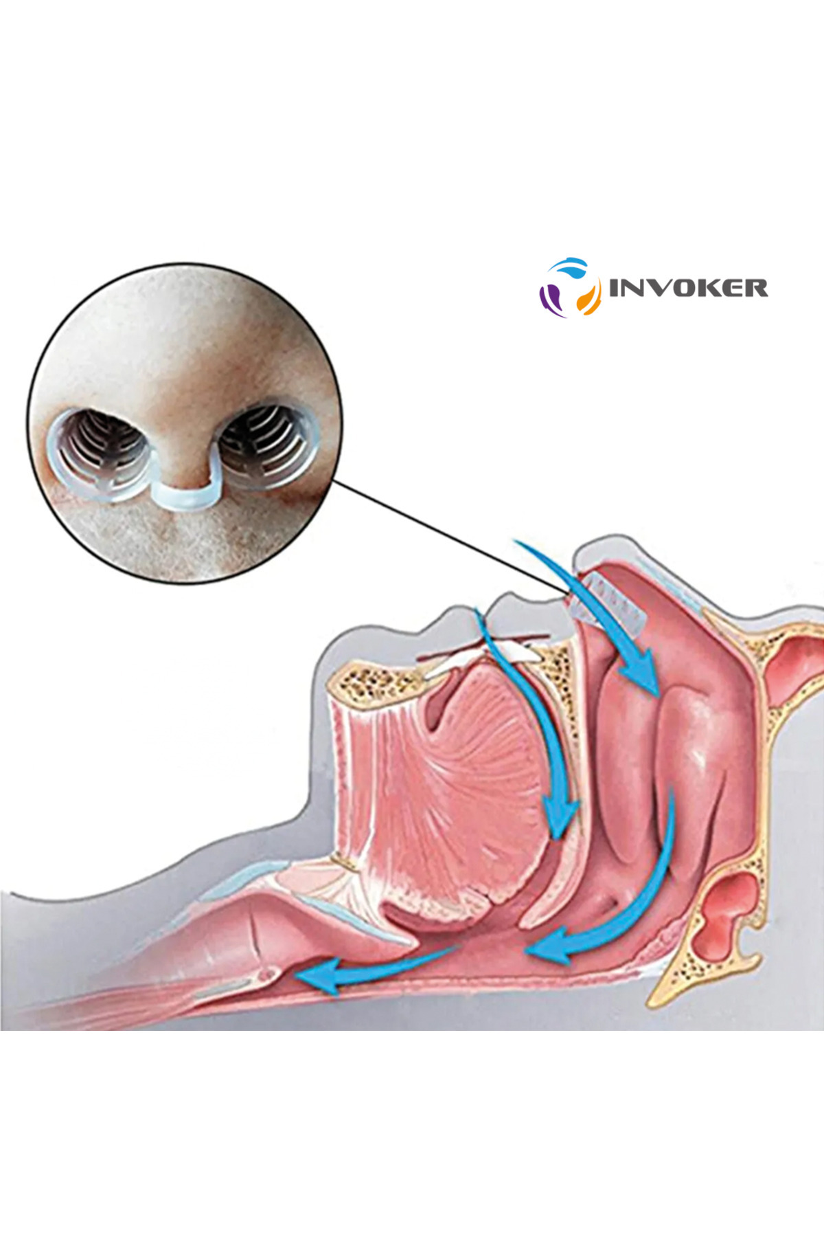 INVOKER-Anti-Snoring Nasal Dilator Intranasal Silicone Apnea Apparatus Nostril Nose Opener Silicone 4 Pieces m 3