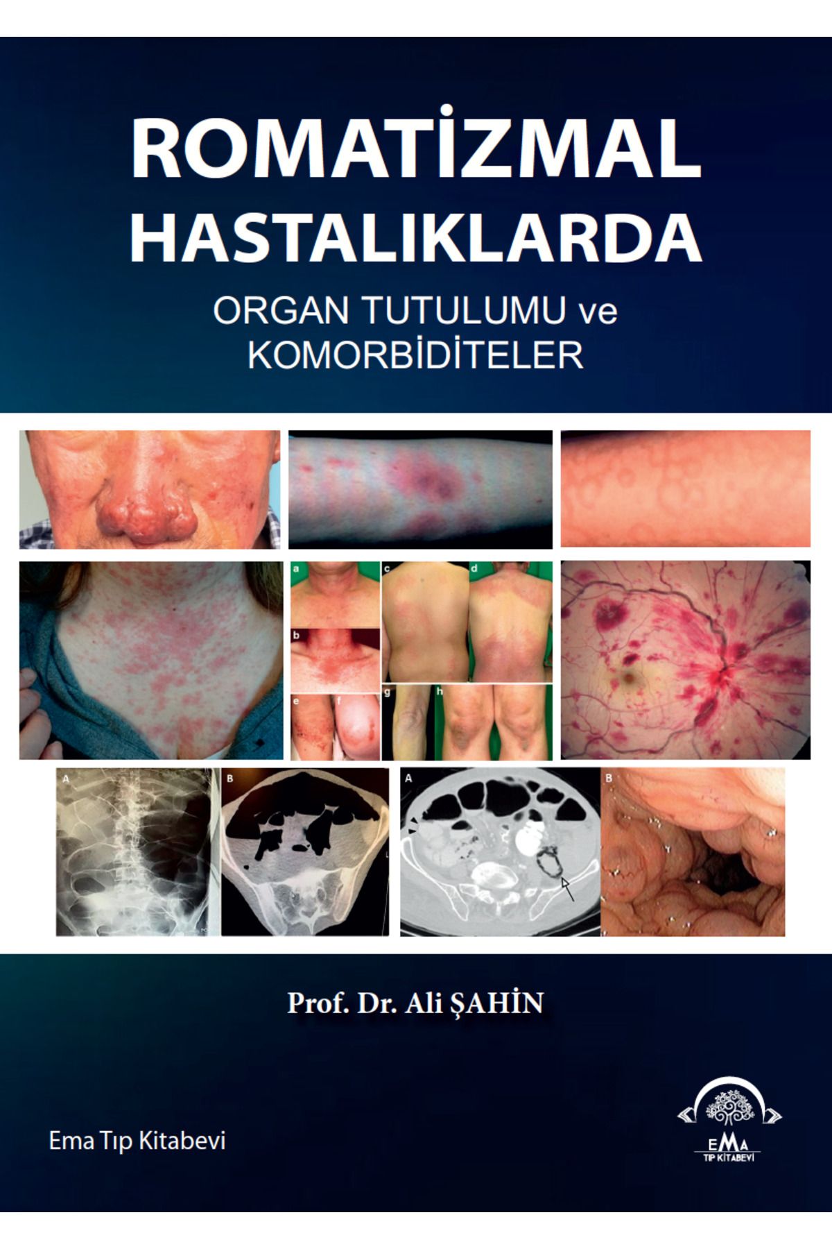 Ema Tıp Kitabevi Romatizmal Hastalıklarda Organ Tutulumu ve Komorbiditeler