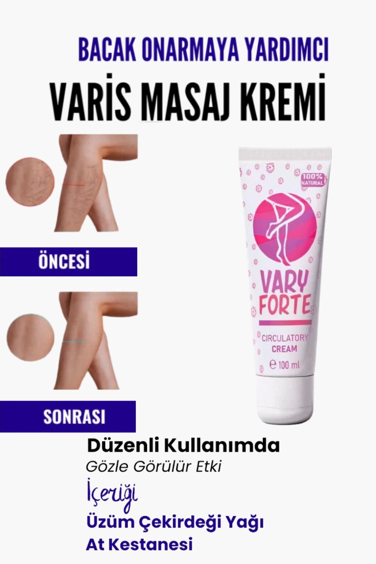MT29 GİYİM Var.is Bölgesi Için Bacak Onarmaya Yardımcı Besleyici Varyforte Masaj Kremi 100ml