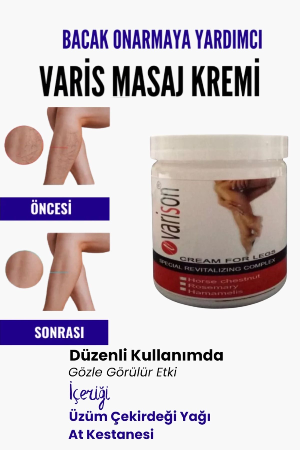 MT29 GİYİM Var.is Bölgesi Için Bacak Onarmaya Yardımcı Ve Besleyici Varison Masaj Kremi 200 ml