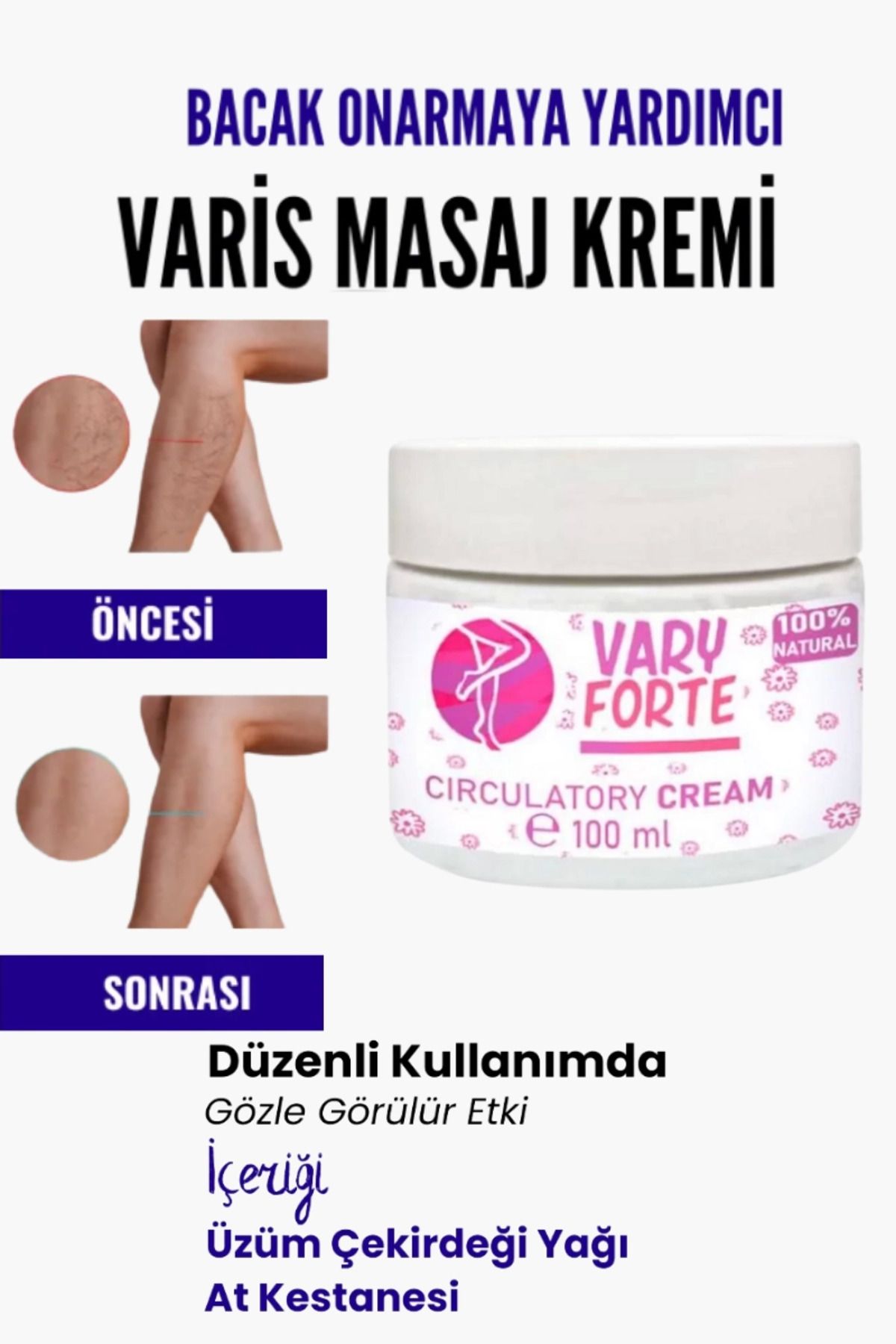 ÖYKÜ VE YİĞİT Var.is Bölgesi Için Bacak Onarmaya Yardımcı Ve Besleyici Varyforte Masaj Kremi 100 ml