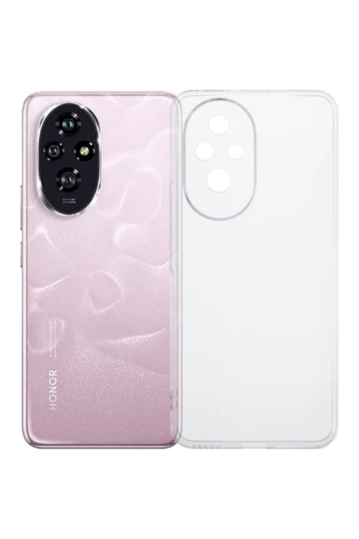 Obay Xshine Hnor 200 Pro Telefon Kılıfı