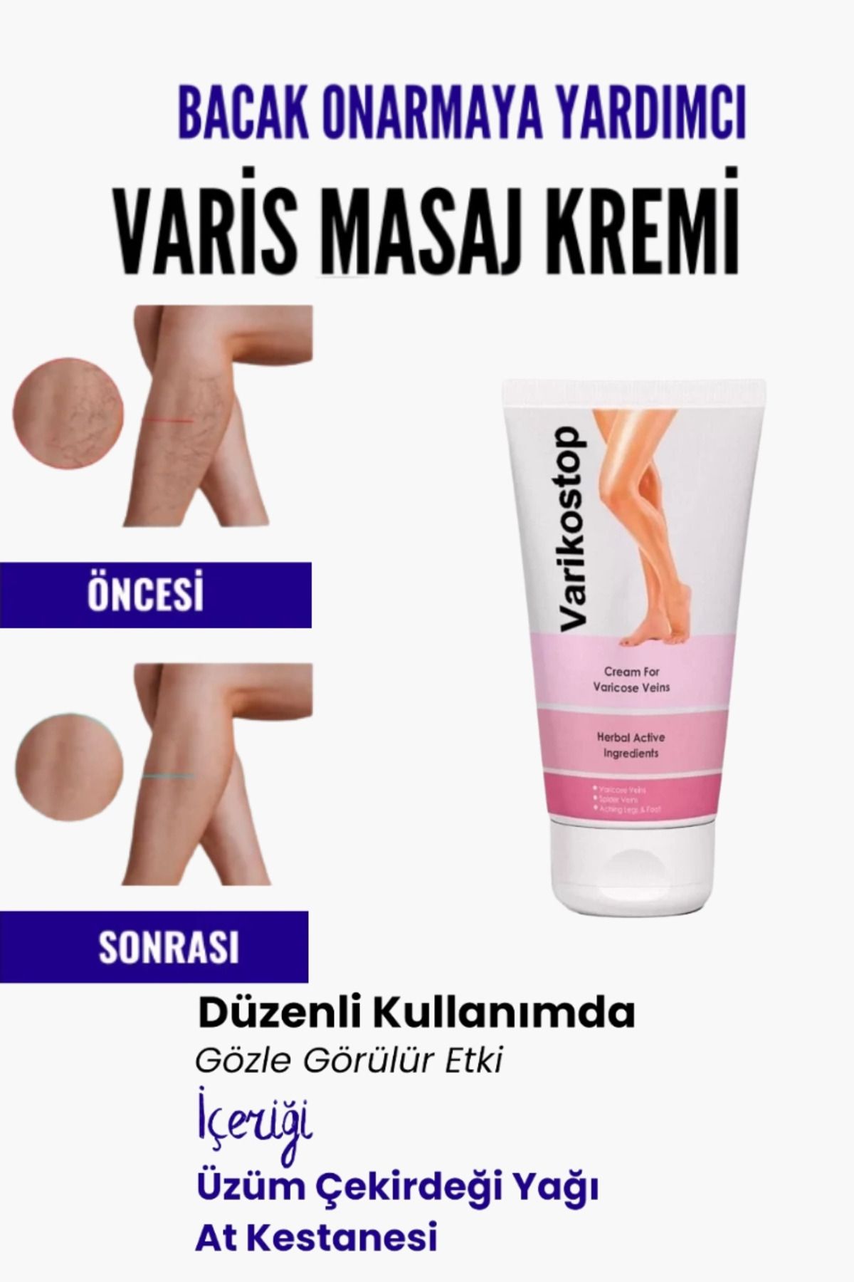 MT29 GİYİM Var.is Bölgesi Için Bacak Onarmaya Yardımcı Ve Besleyici Varikostop Masaj Kremi 200 ml