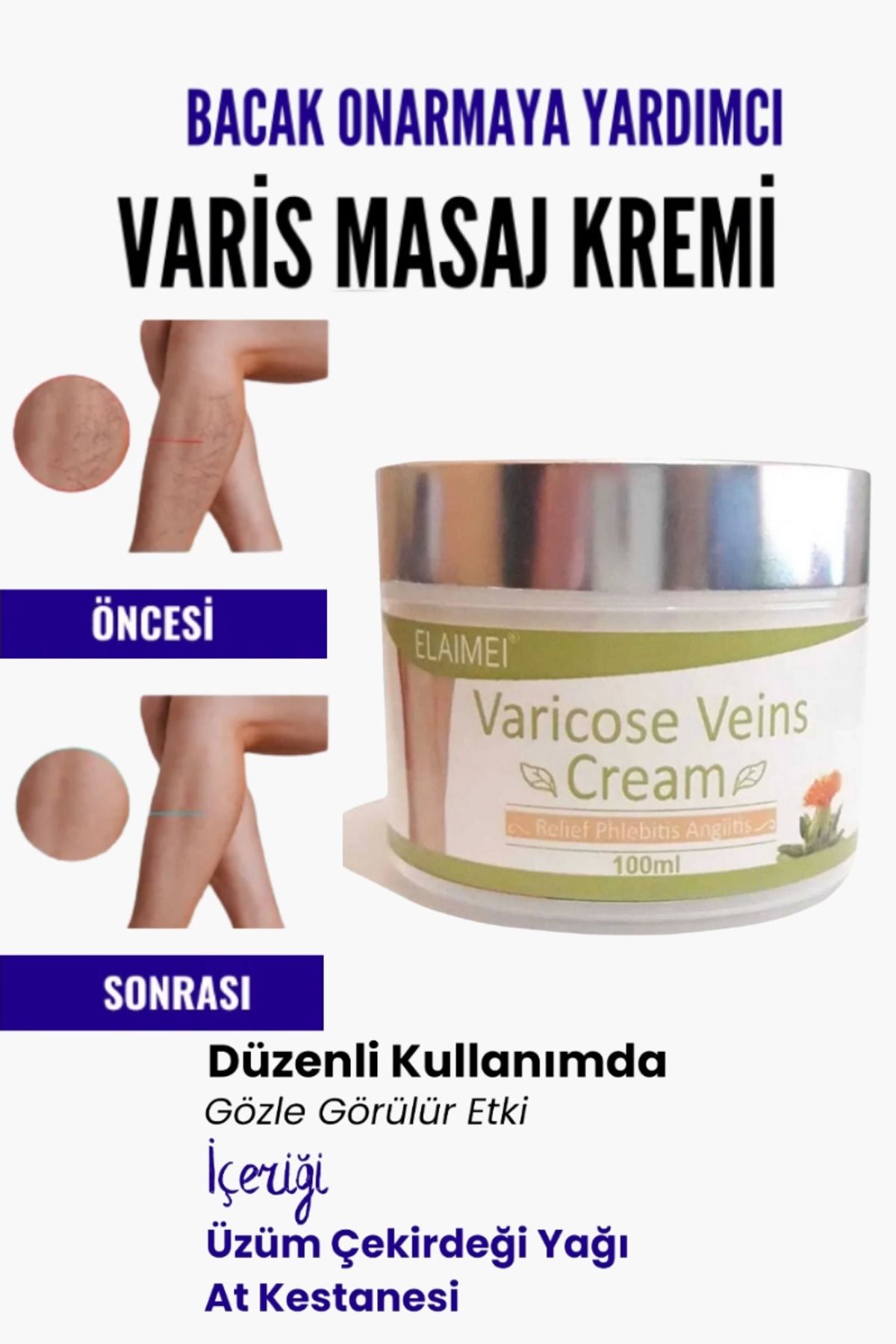 MT29 GİYİM Var.is Bölgesi Için Bacak Onarmaya Yardımcı Ve Besleyici Varicose Masaj Kremi 100 ml