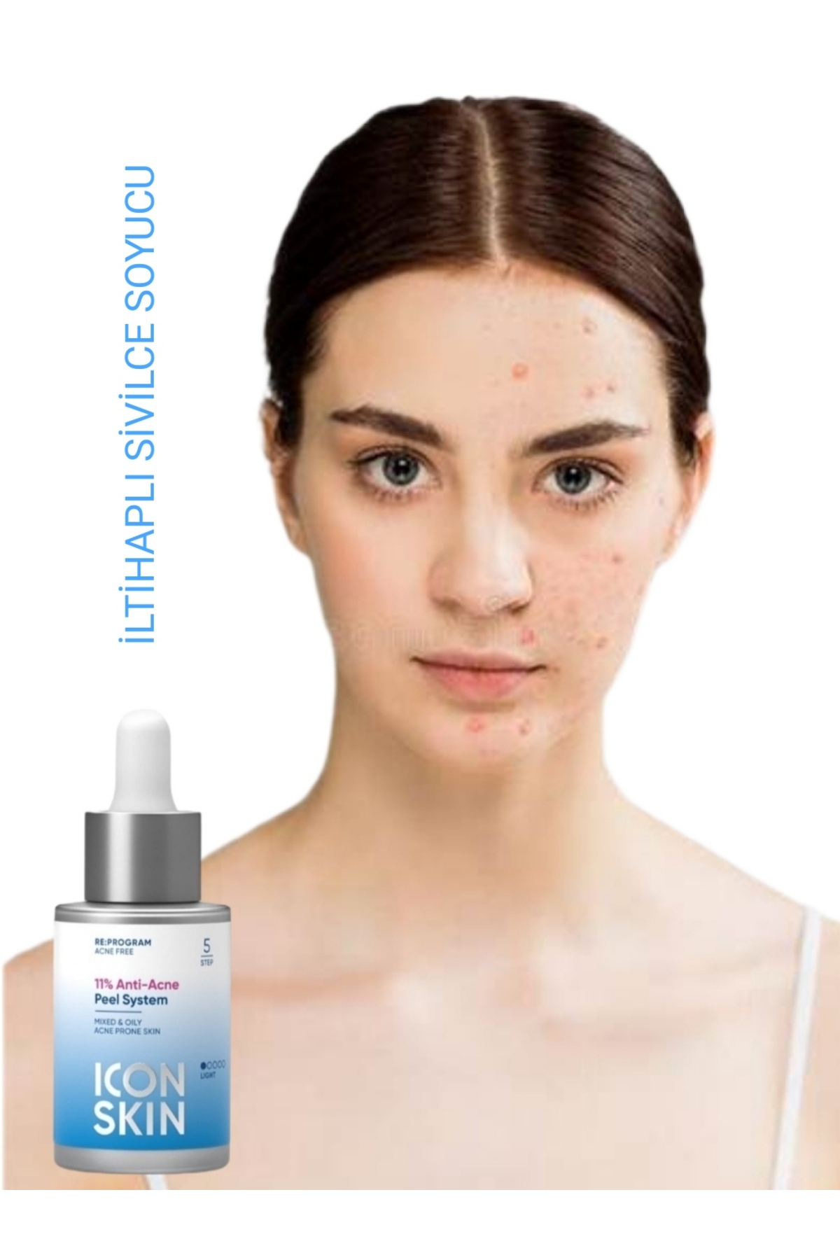 Sivilceye Eğilimli Sorunlu Ciltler Için Iltihap Giderici & Sivilc e Izleri Silici % 11 Peeling — İFS627 — تصویر 2 از 3