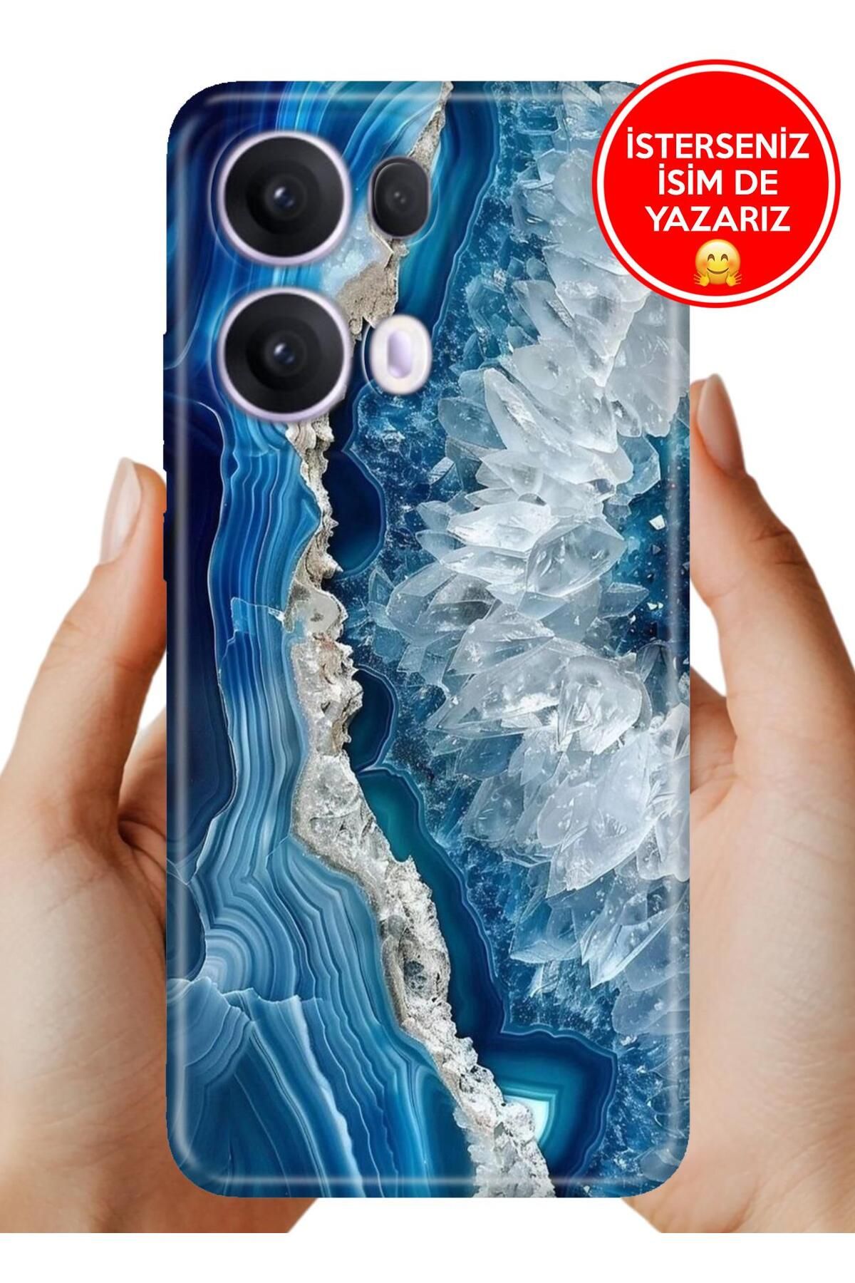 OPPO Reno 13 Pro Kılıf Oppo Reno 13 Pro A Kalite Baskılı Art Silikon OttoMarble