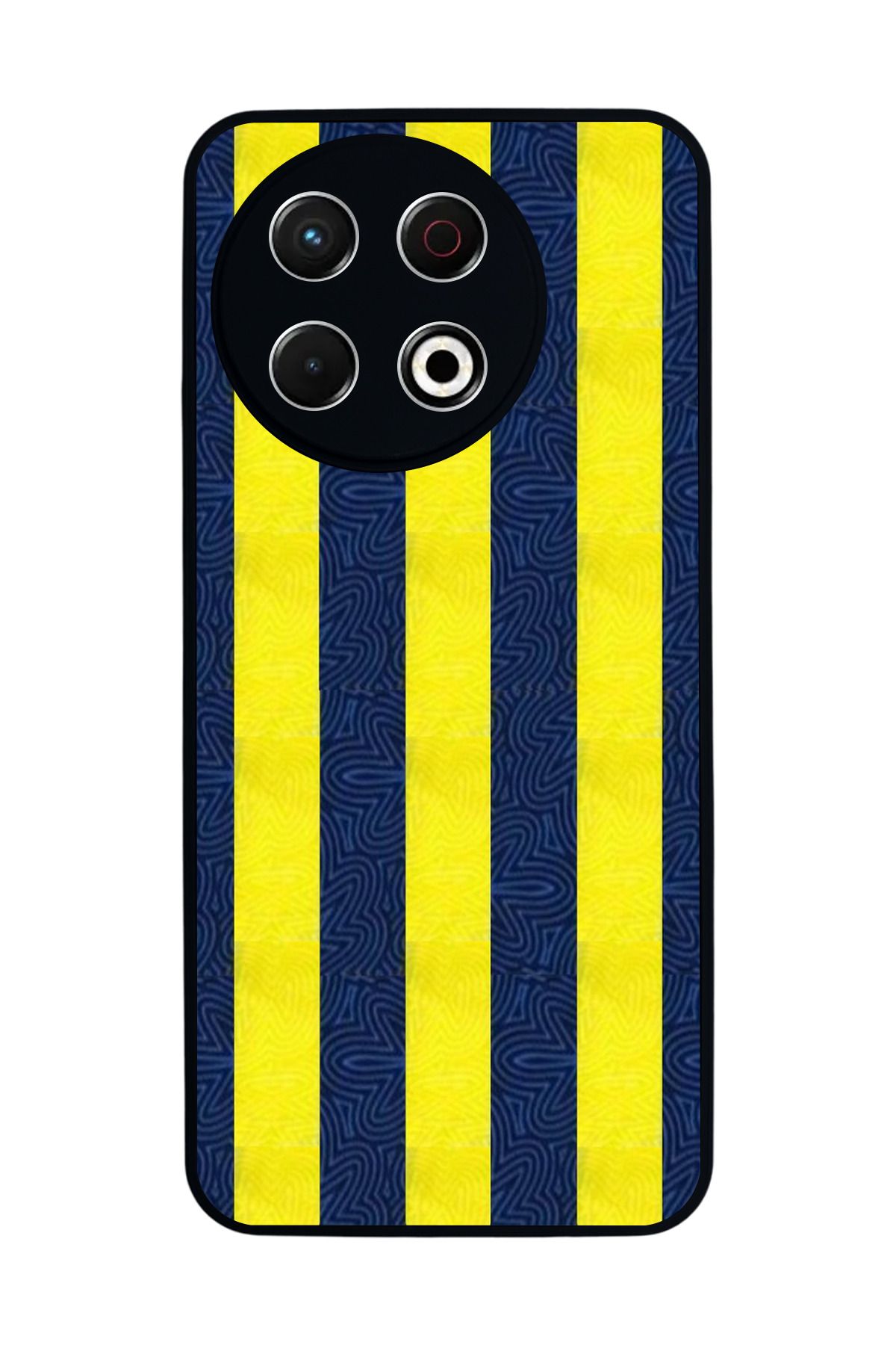 TECNO Spark 30 Pro Mat Siyah Kılıf – Yumuşak Silikon, Koruyucu, Şok Emici Kapak