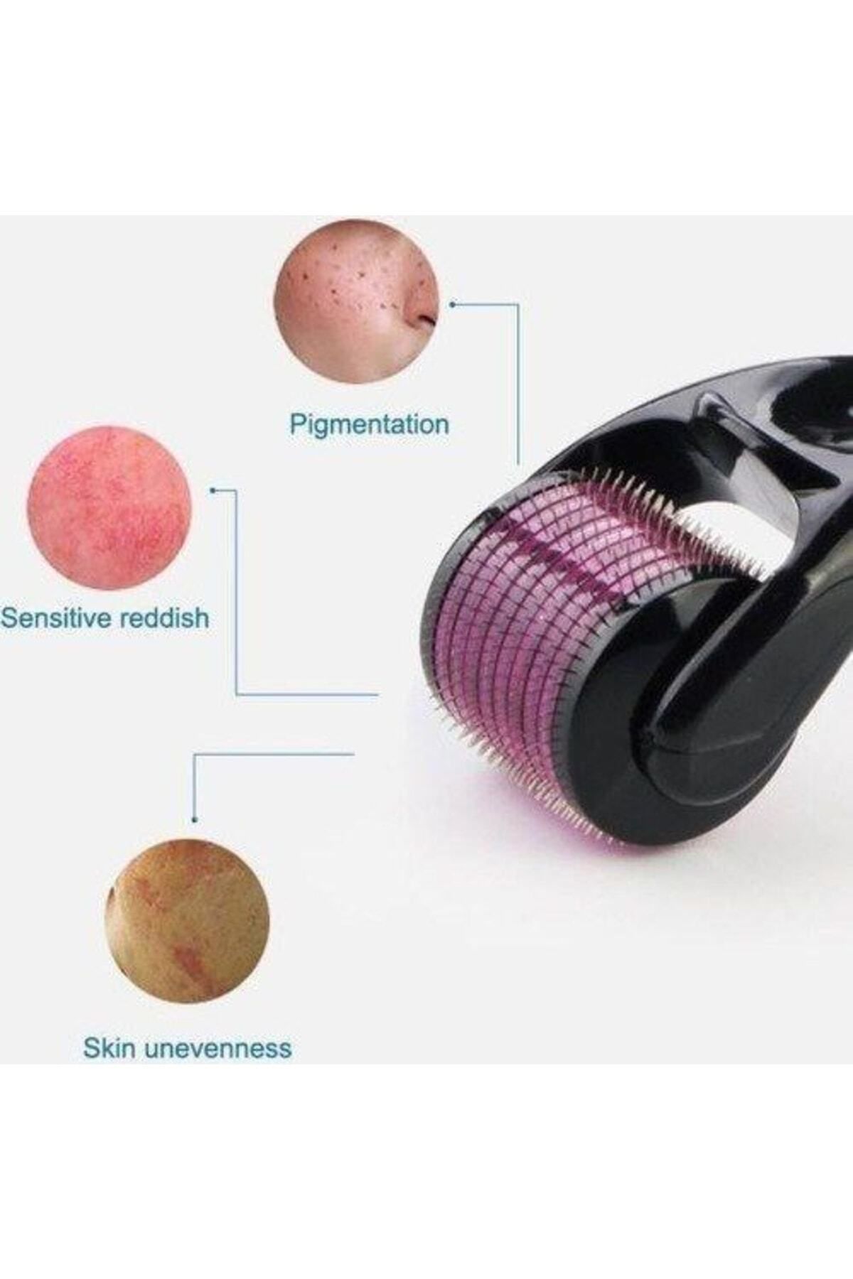AboutThePerfect Titanyum Uçlu 540 Iğneli Derma Roller 0,75 mm - Cilt ve Vücut Yenileme Masaj Aleti