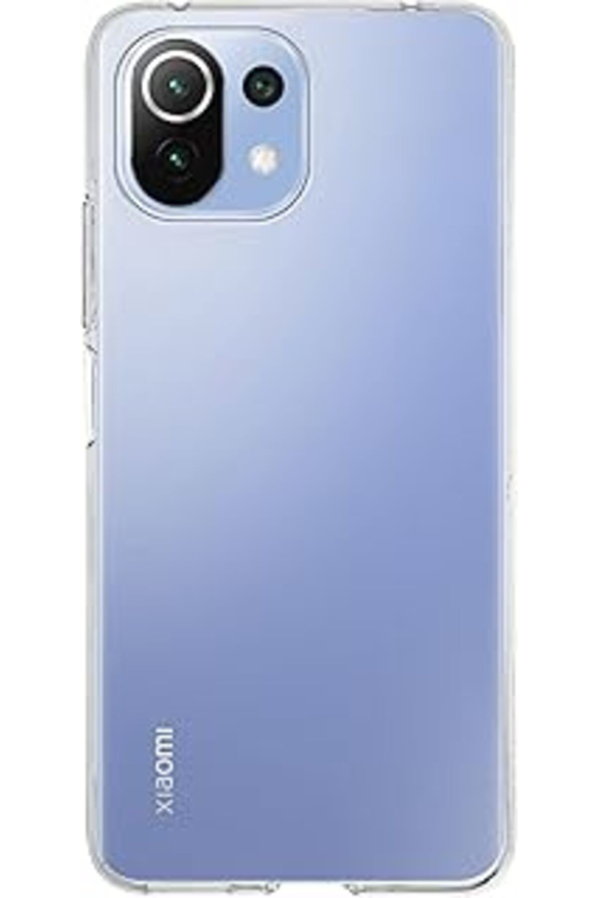 Karachil Kzy İletişim Xiaomi Mi 11 Lite Ile Uyumlu Kapak 1Mm Şeffaf Silikon Kılıf